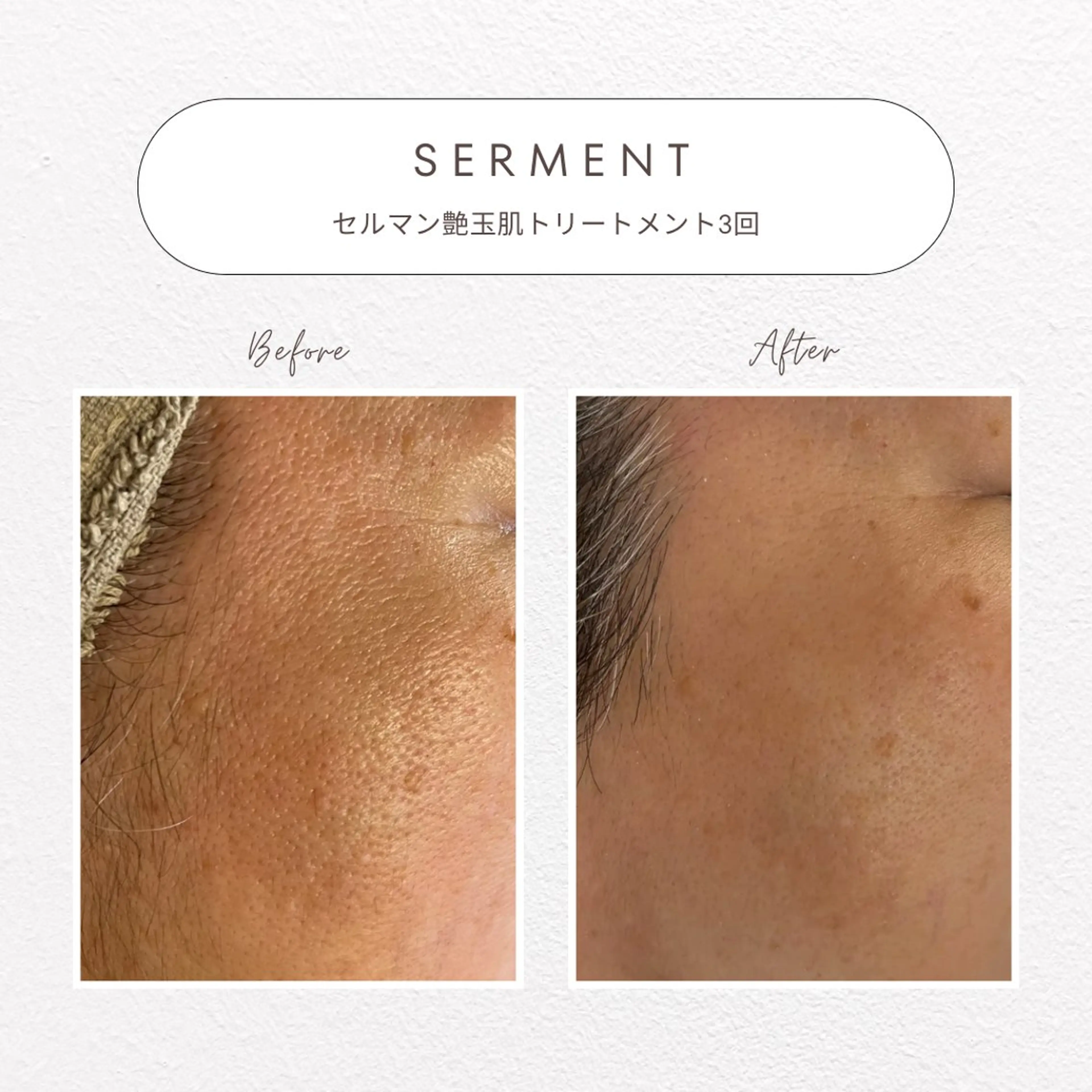 エステ beaute LABO所属・大宮肌管理サロン sayakaのエステ・リラクイメージ