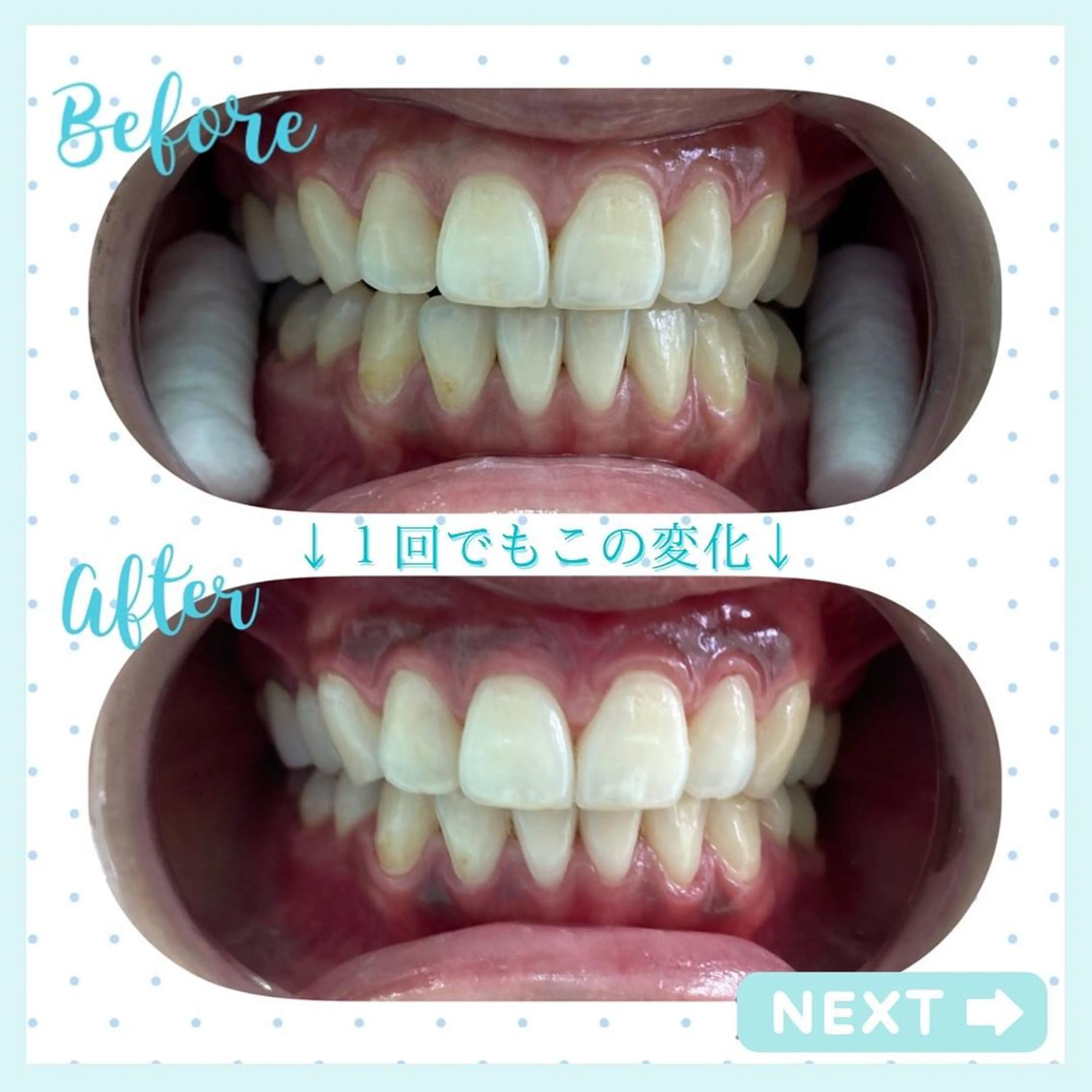 その他 セルフホワイトニングCOCOSHIRO所属・セルフホワイトニング COCOSHIROのエステ・リラクイメージ