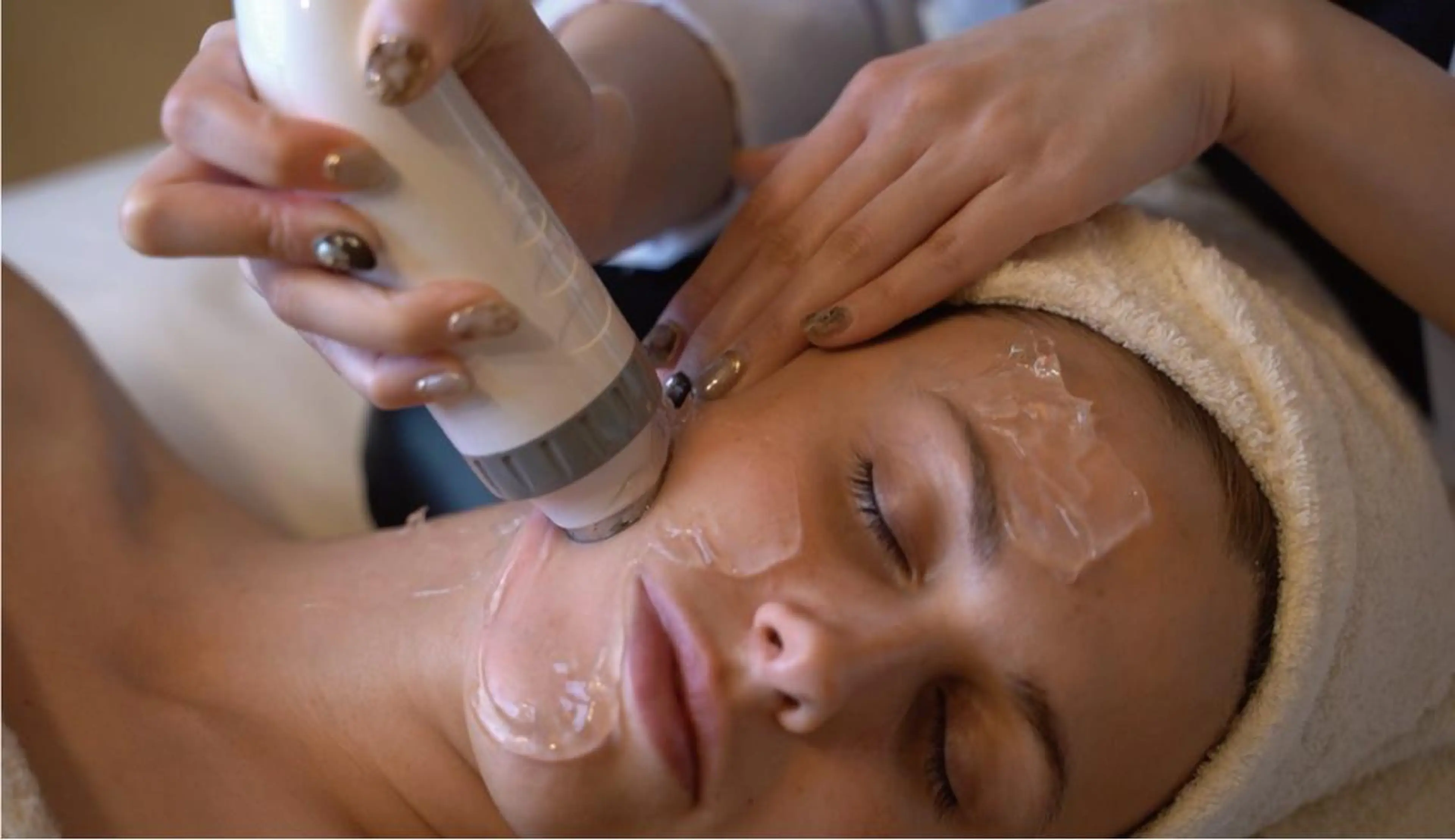 医師も認めたICEラジオ波（＋デコルテ初回¥1500（10分））1回でリフトアップ効果ありの写真