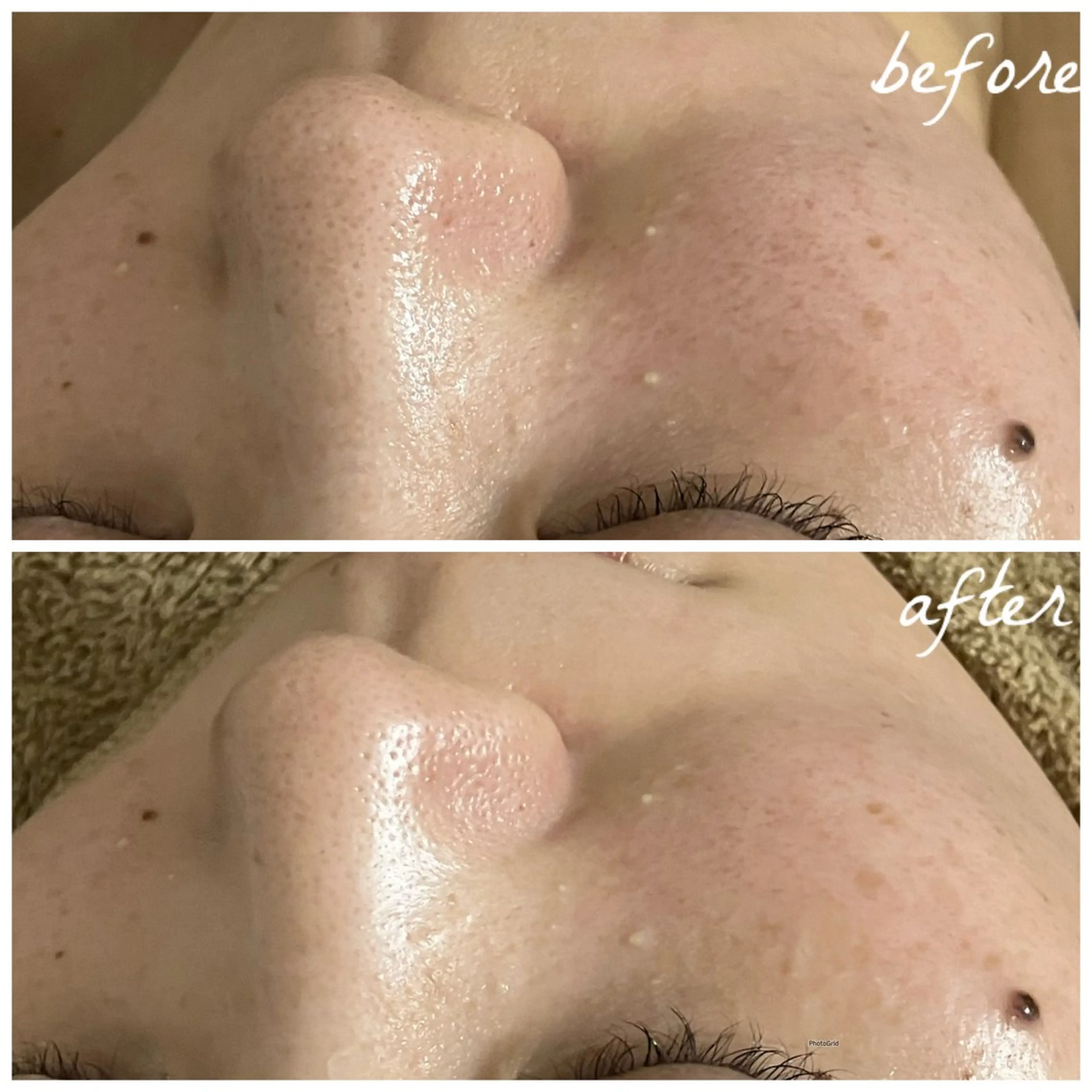 メンズ エステ メナード岐阜茜部 杉浦のエステ・リラクイメージ