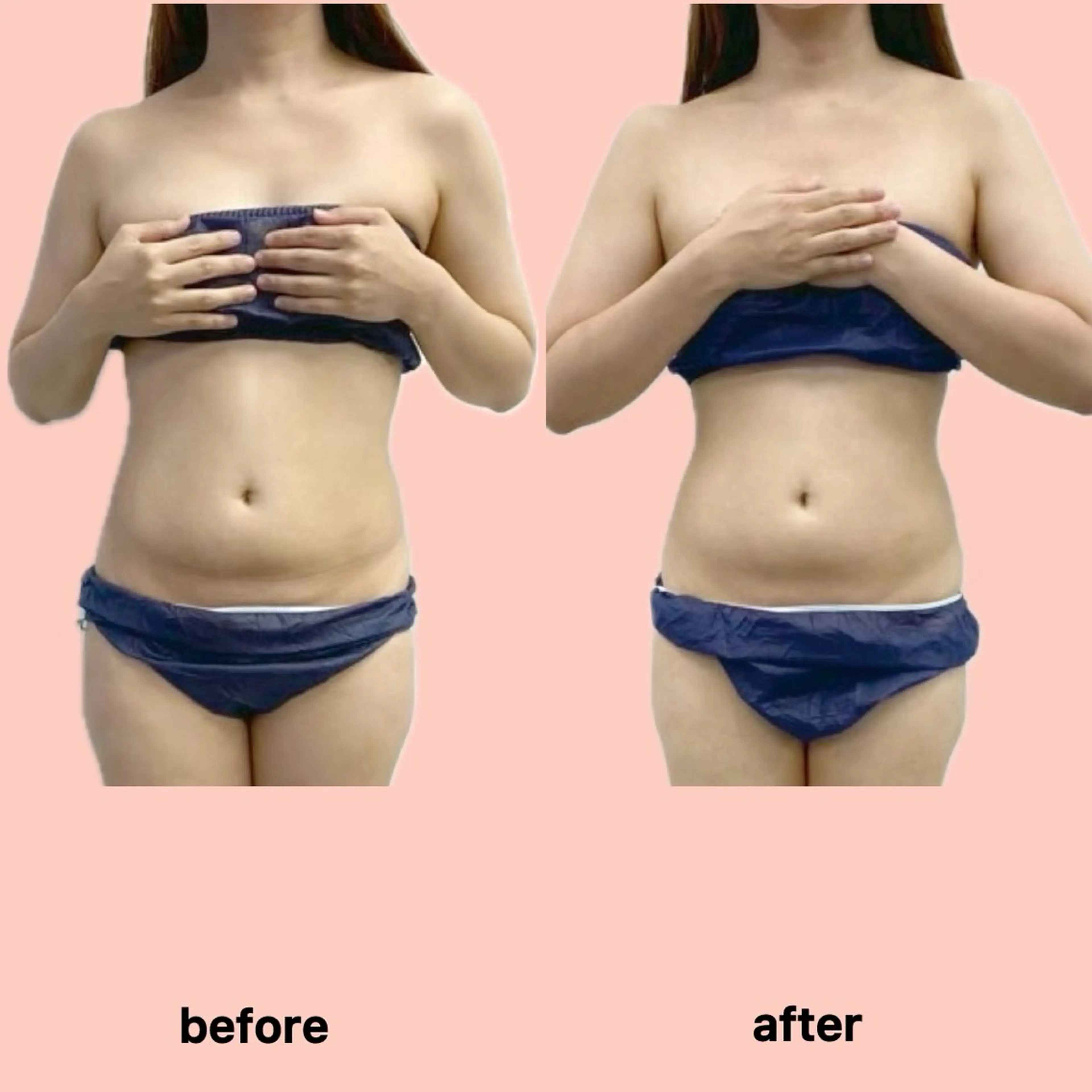 その他 gleam ü 枚方公園のエステ・リラクイメージ