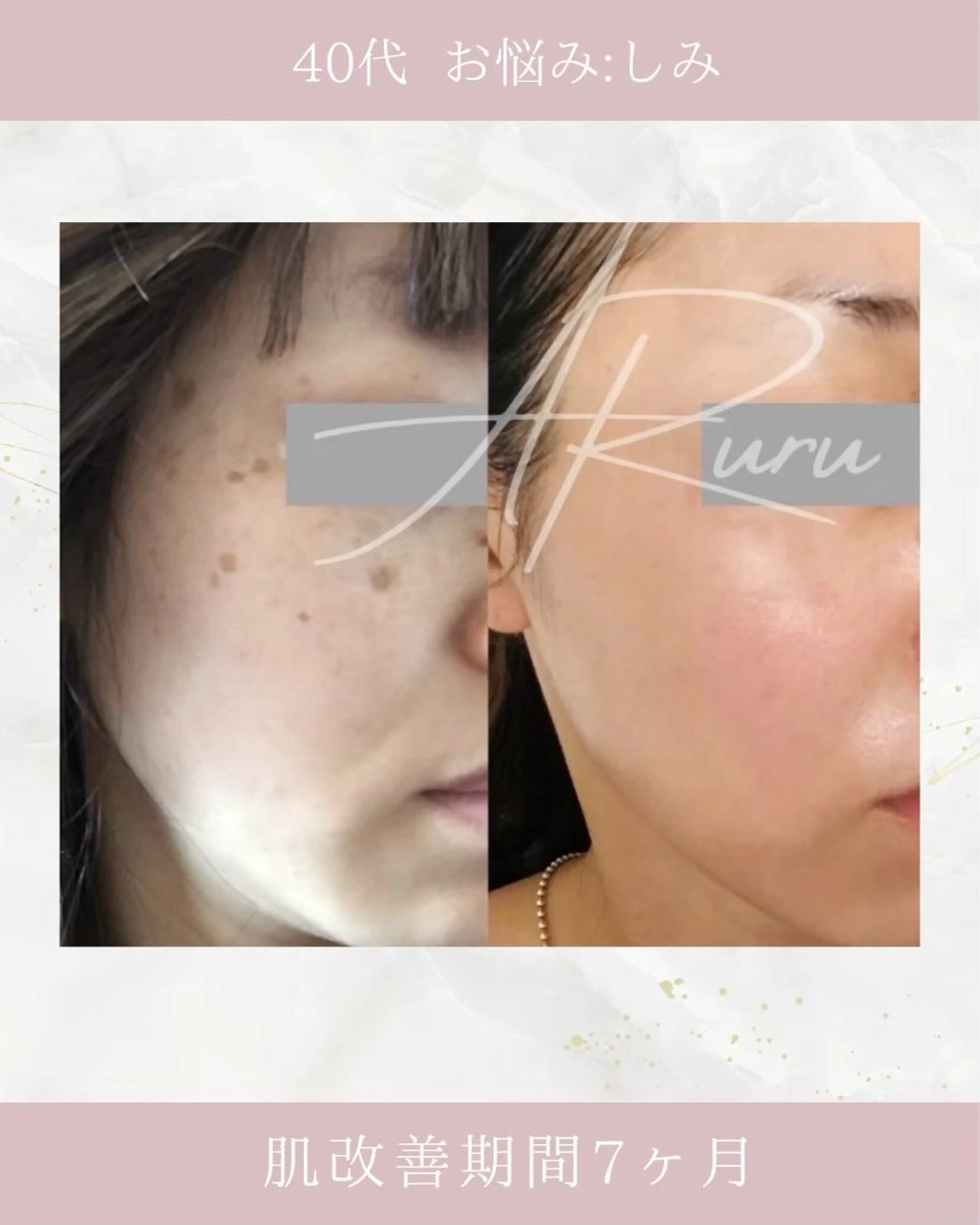 ARuru所属・ARuru 本店のエステ・リラクイメージ