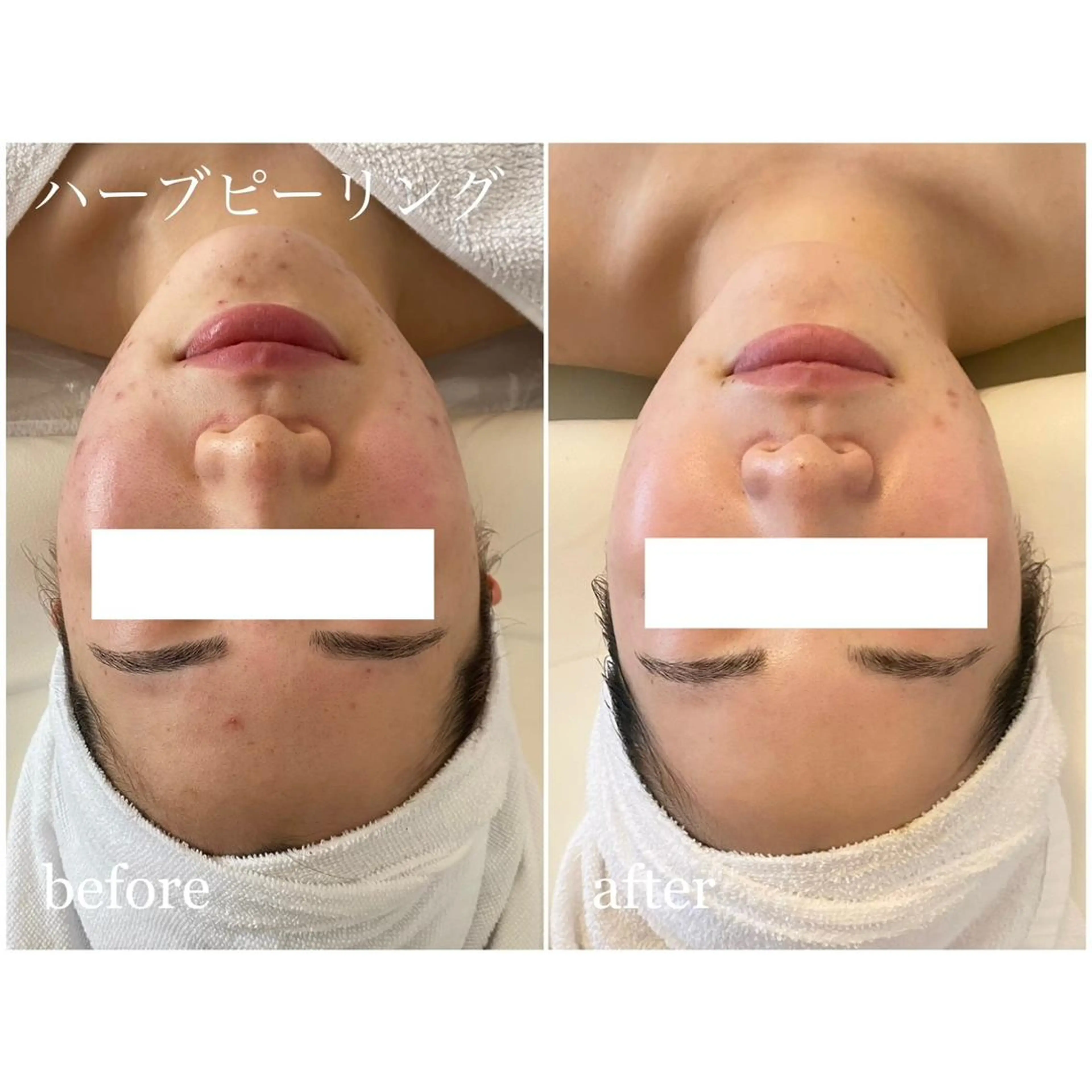 I'm -ｲﾑ-所属・肌質改善／ブライダル I'm.-イム-のエステ・リラクイメージ