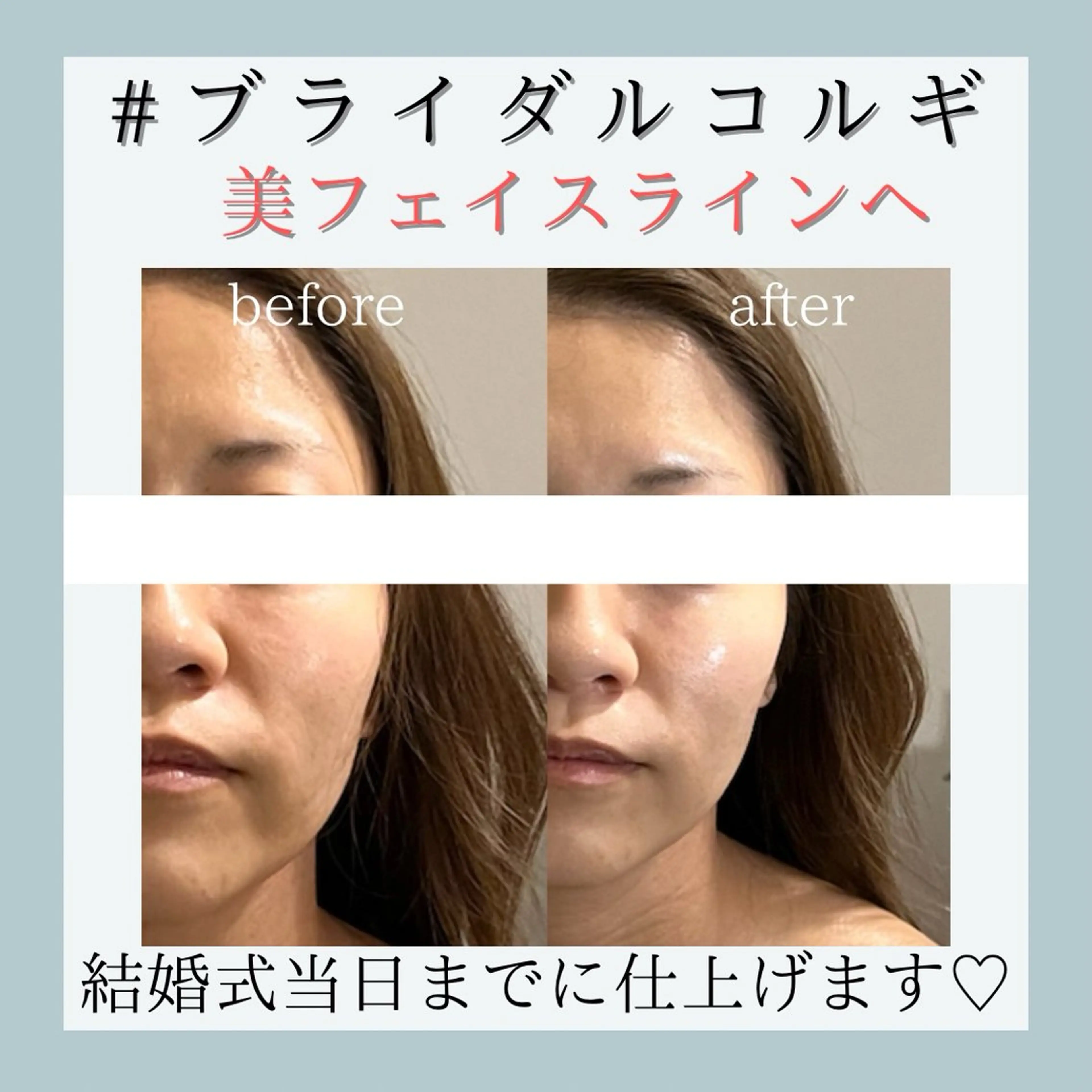 小嶋萌 今池駅徒歩2分のエステ・リラクイメージ