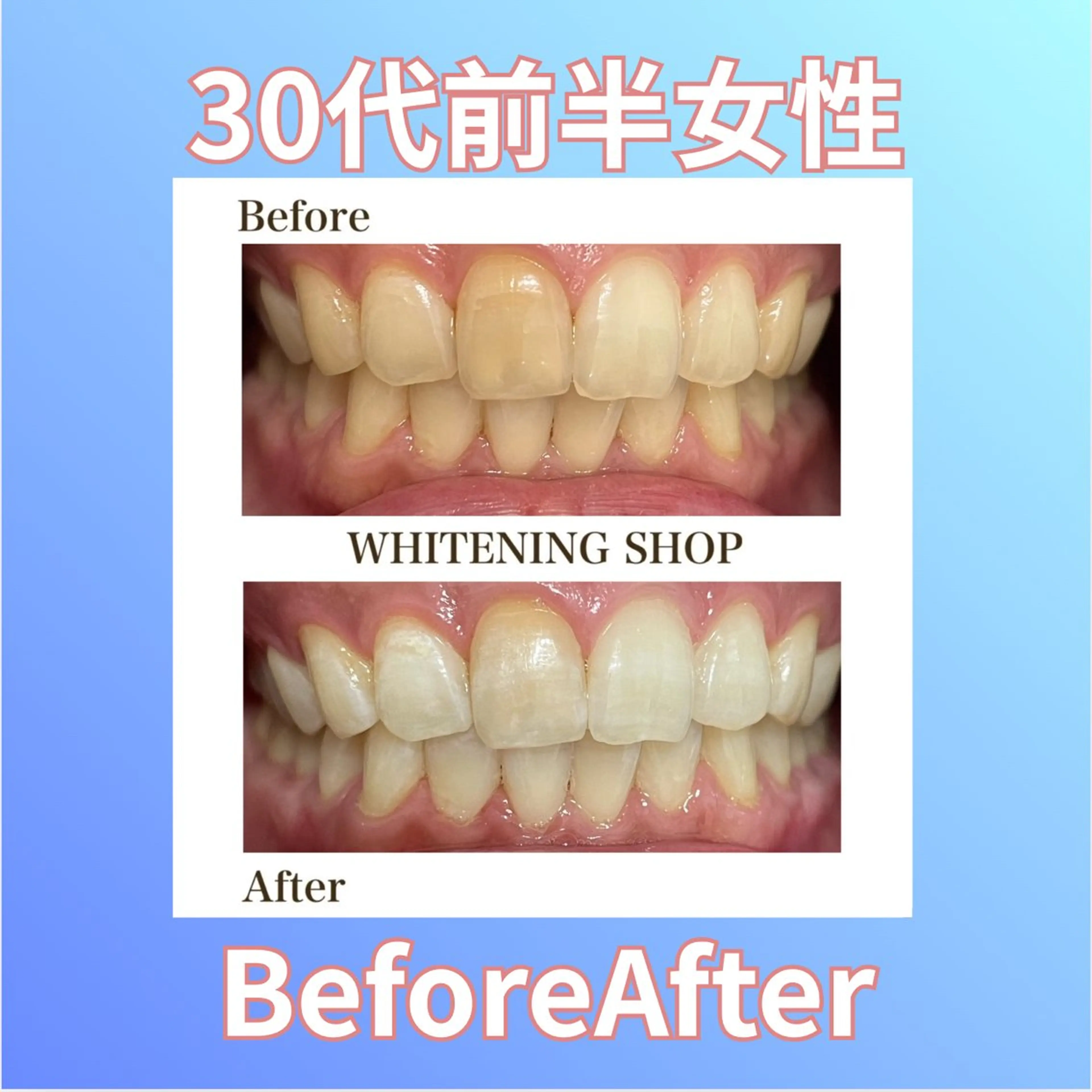 ホワイトニングショップ西原所属・下川 藍子のその他イメージ