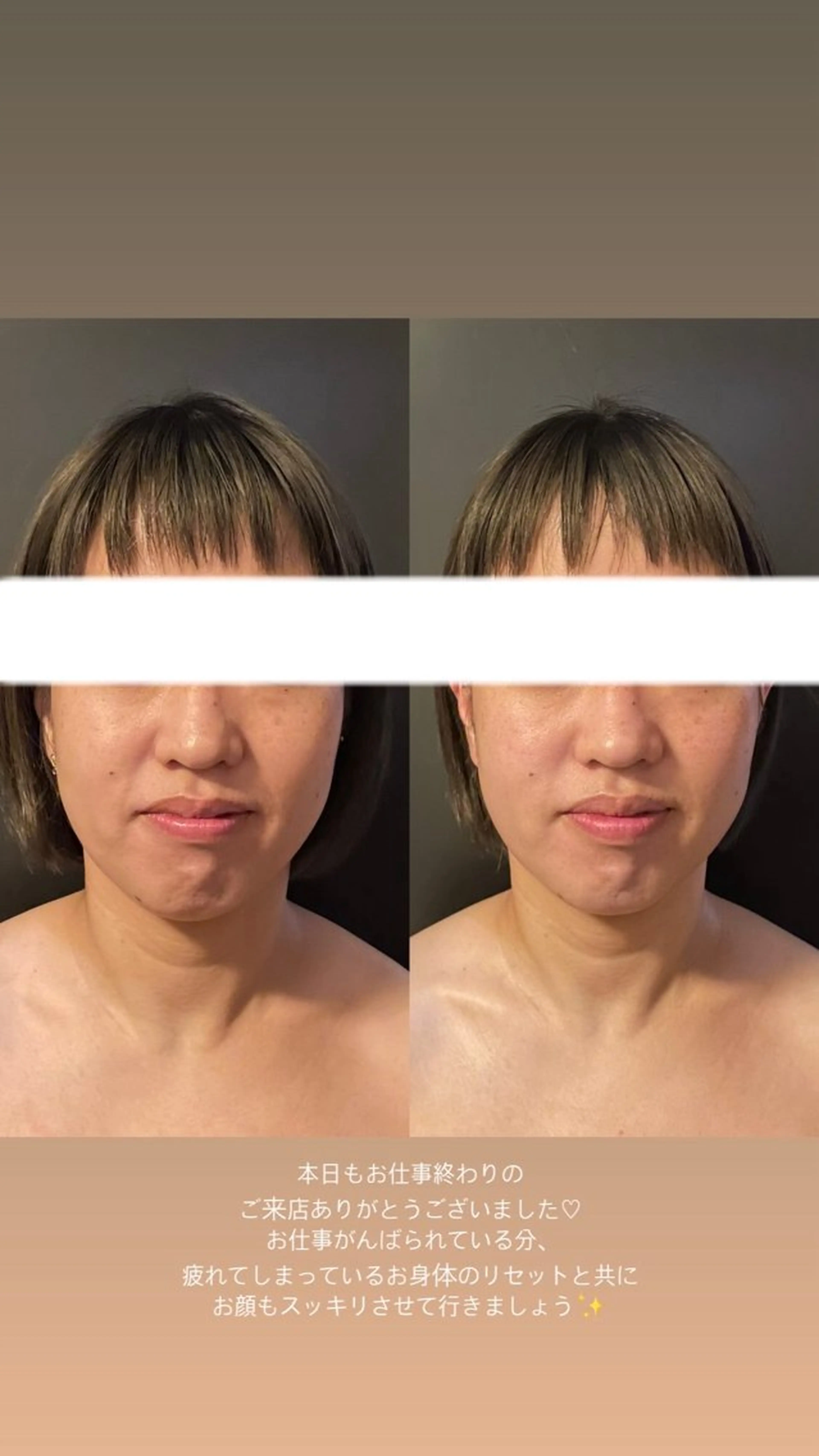 エステ リラク エステサロンino.colore'所属・小顔サロン ino.coloreのエステ・リラクイメージ