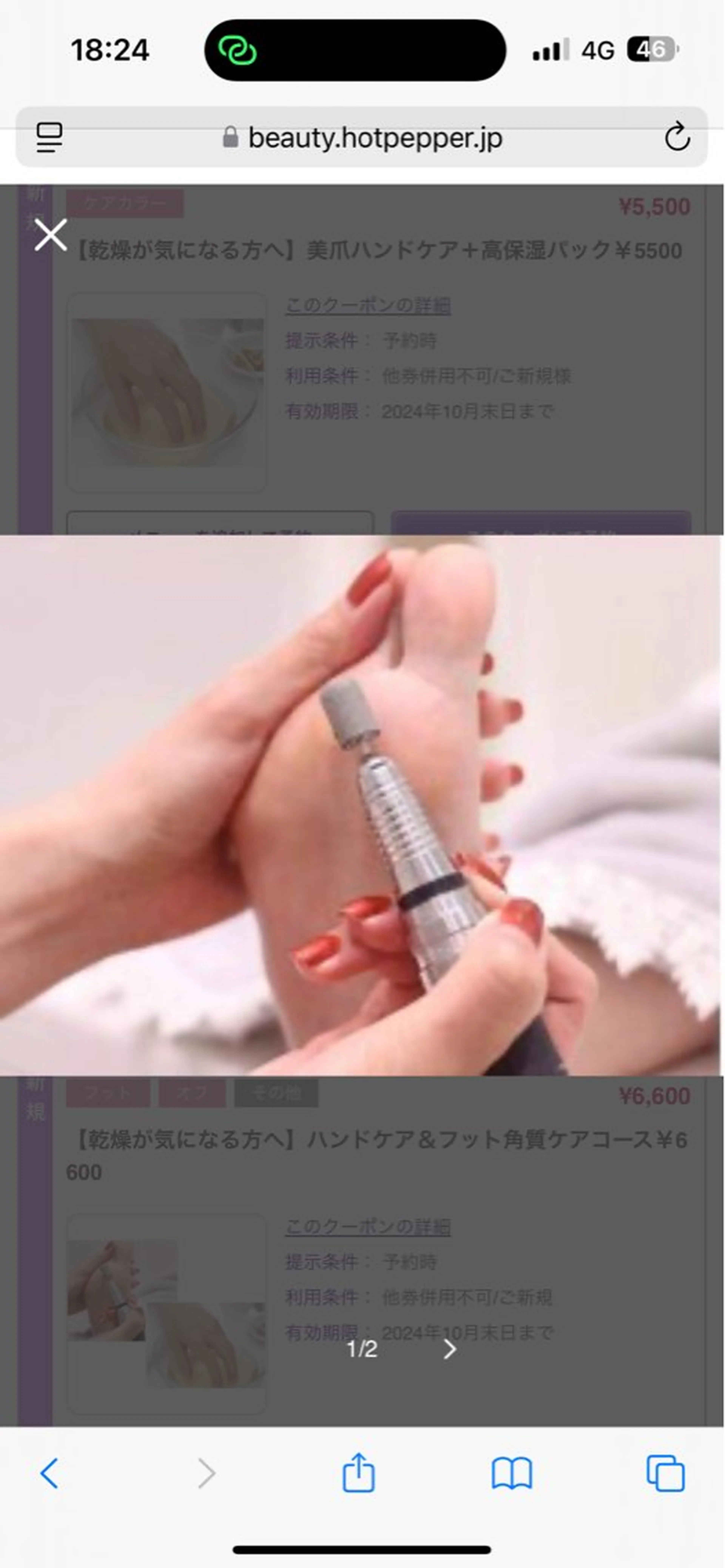 ドイツ式角質ケアの写真