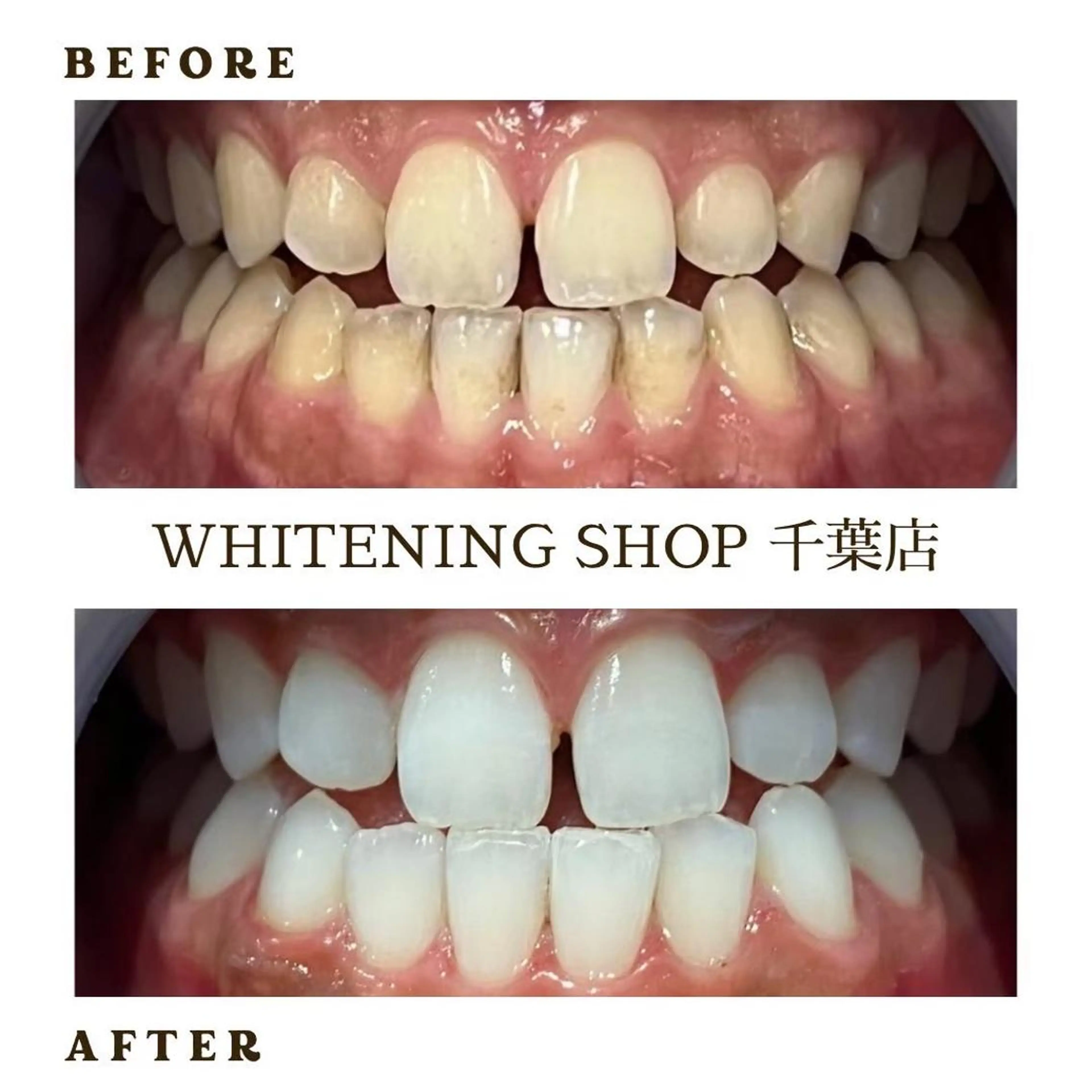 メンズ エステ ホワイトニング ショップ千葉店のその他イメージ