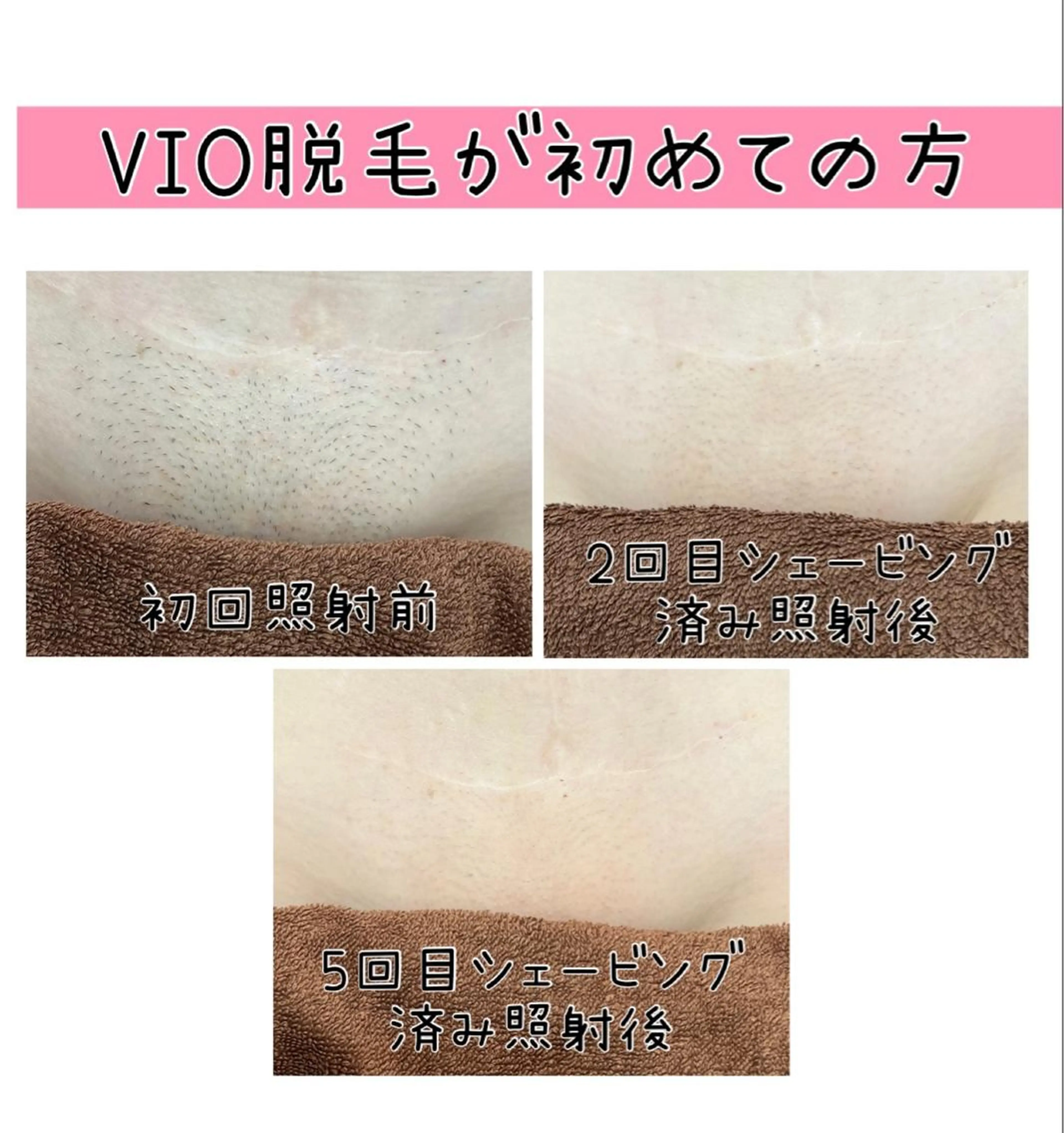 脱毛 毛穴改善/脱毛 ネイル　川上久仁子のエステ・リラクイメージ