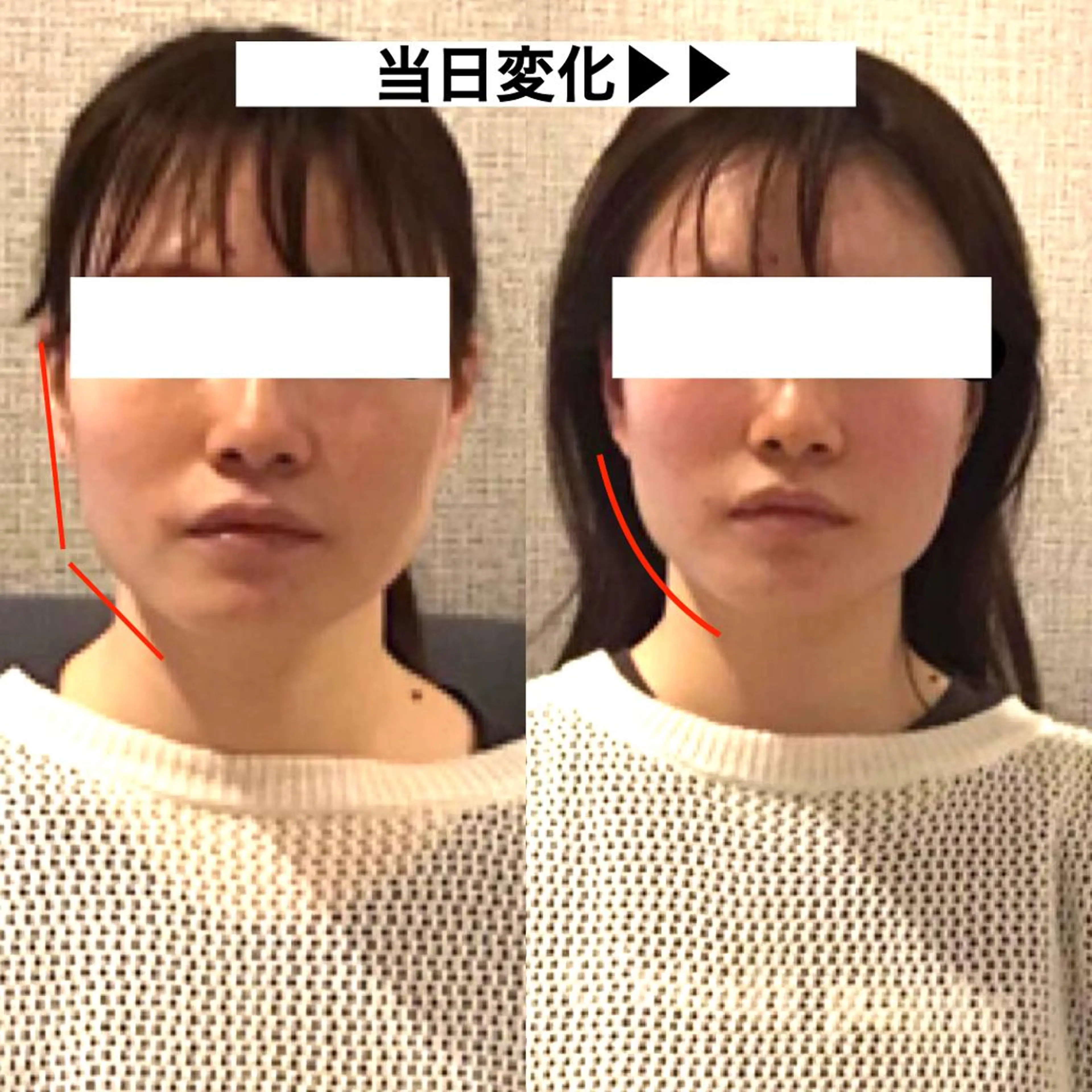 顔の歪み矯正専門 宮内翔のエステ・リラクイメージ