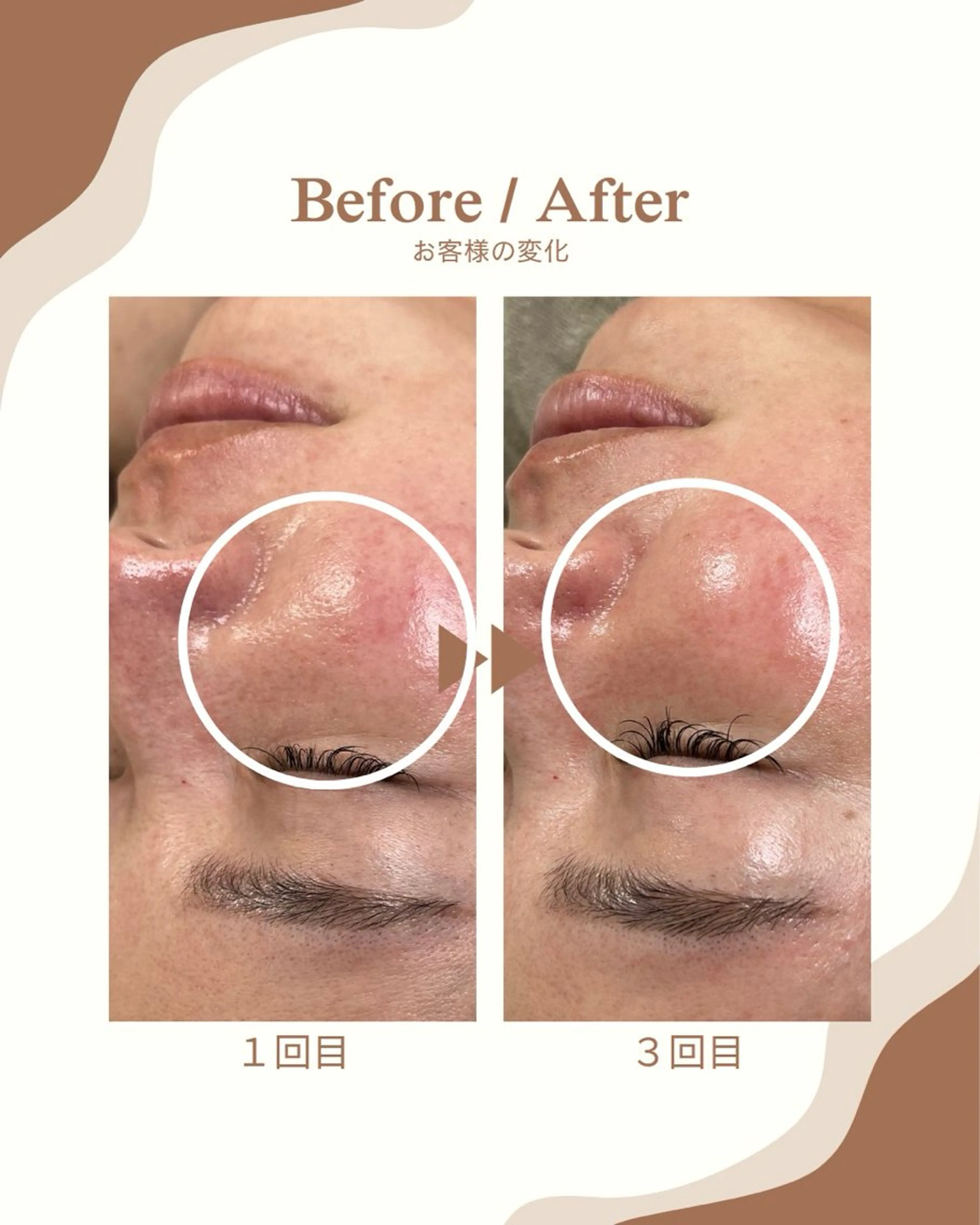 エステ 1st｜フェイシャル エステ専門店のエステ・リラクイメージ