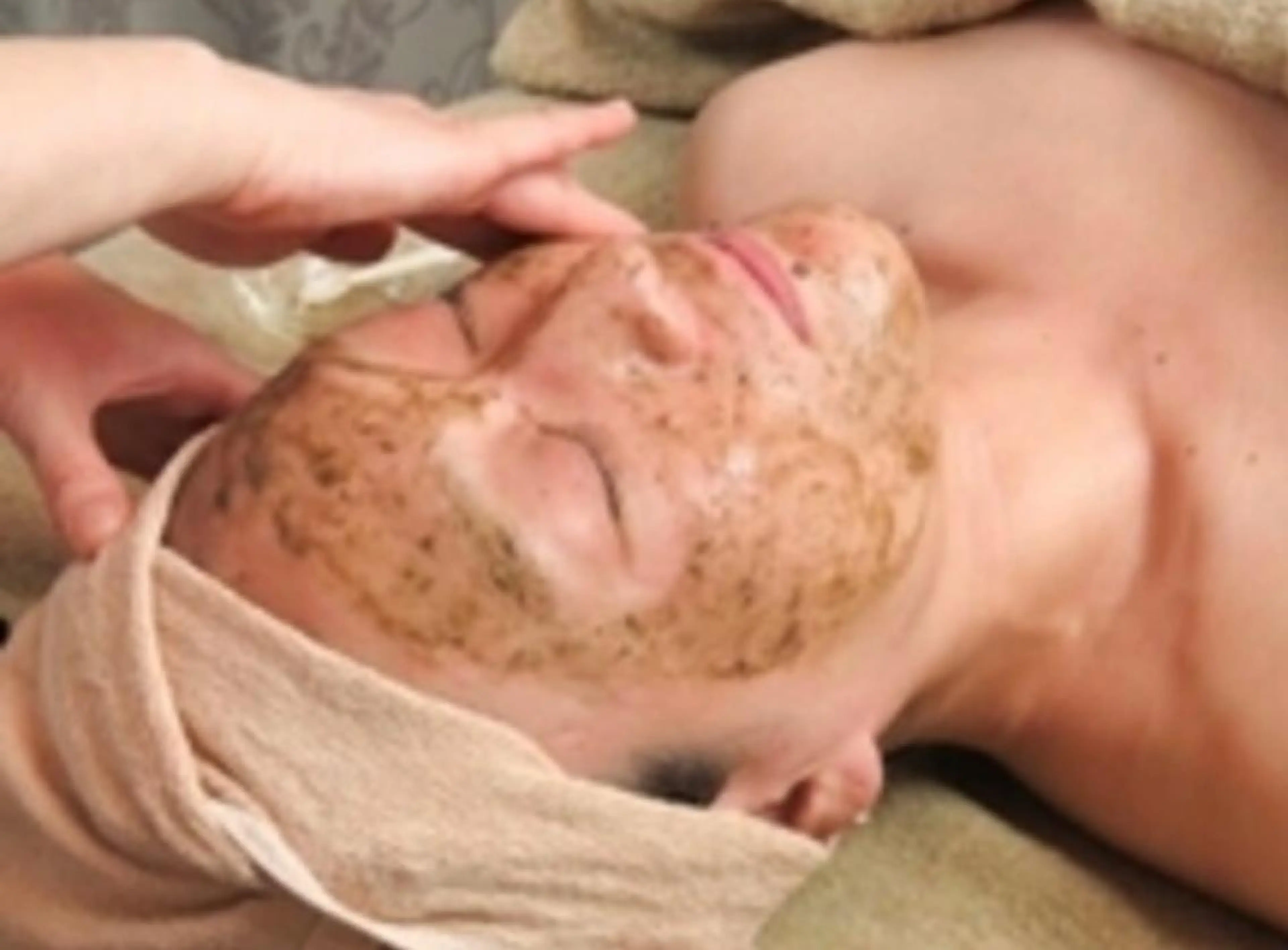 【初回限定】ソフトハーブピーリング(全顔)の写真