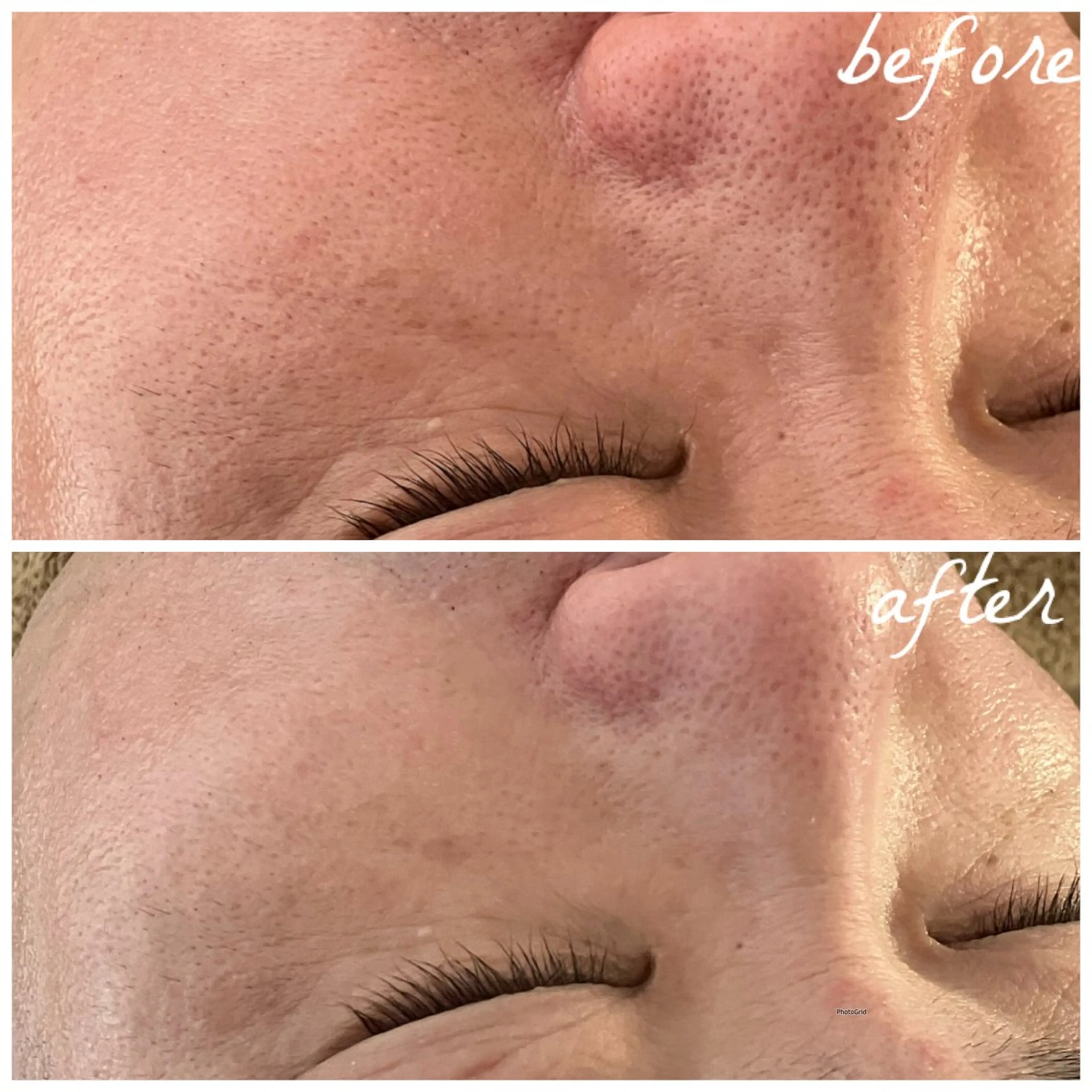 メンズ エステ メナード岐阜市茜部 杉浦のエステ・リラクイメージ