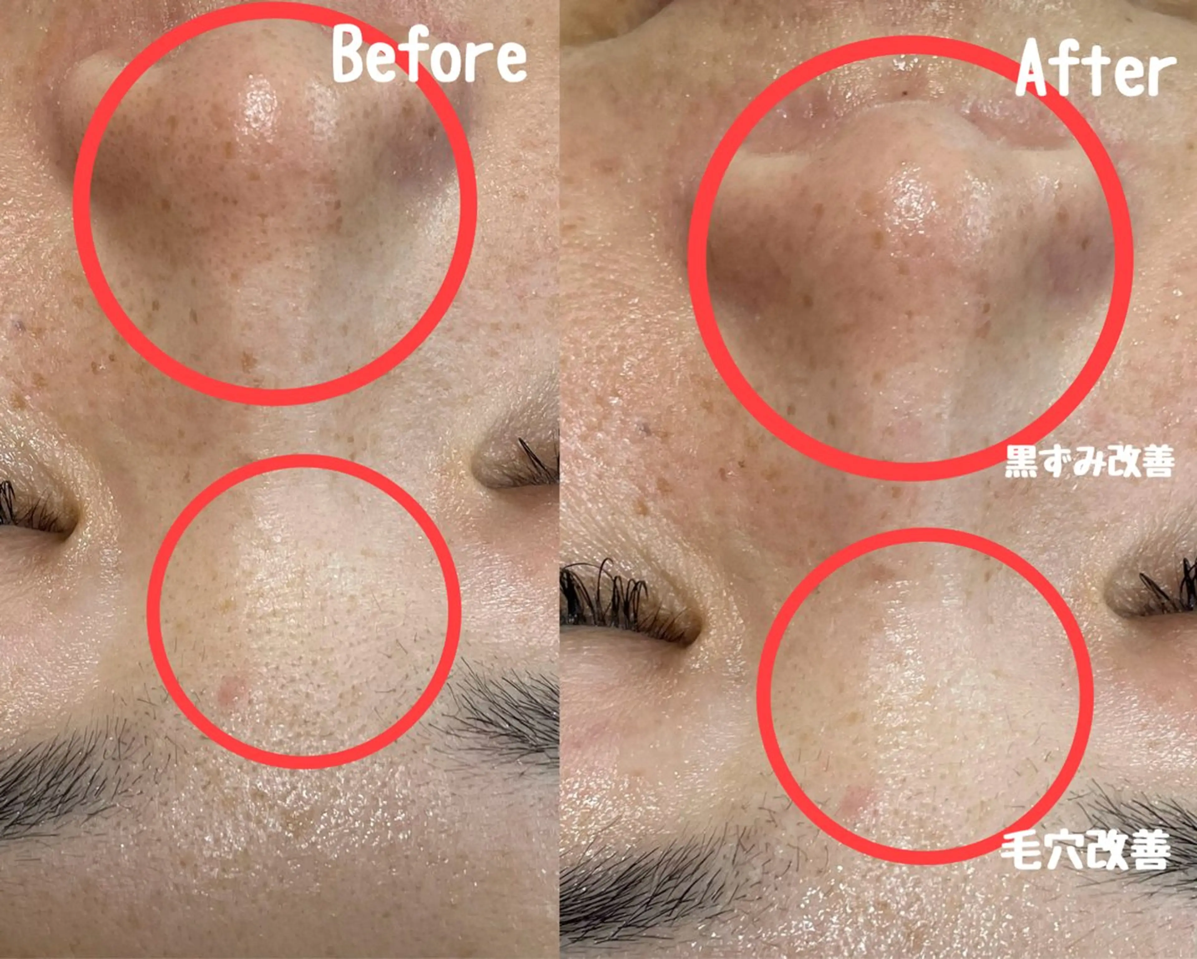 エステ リラク Surien 水脇ゆうのその他イメージ