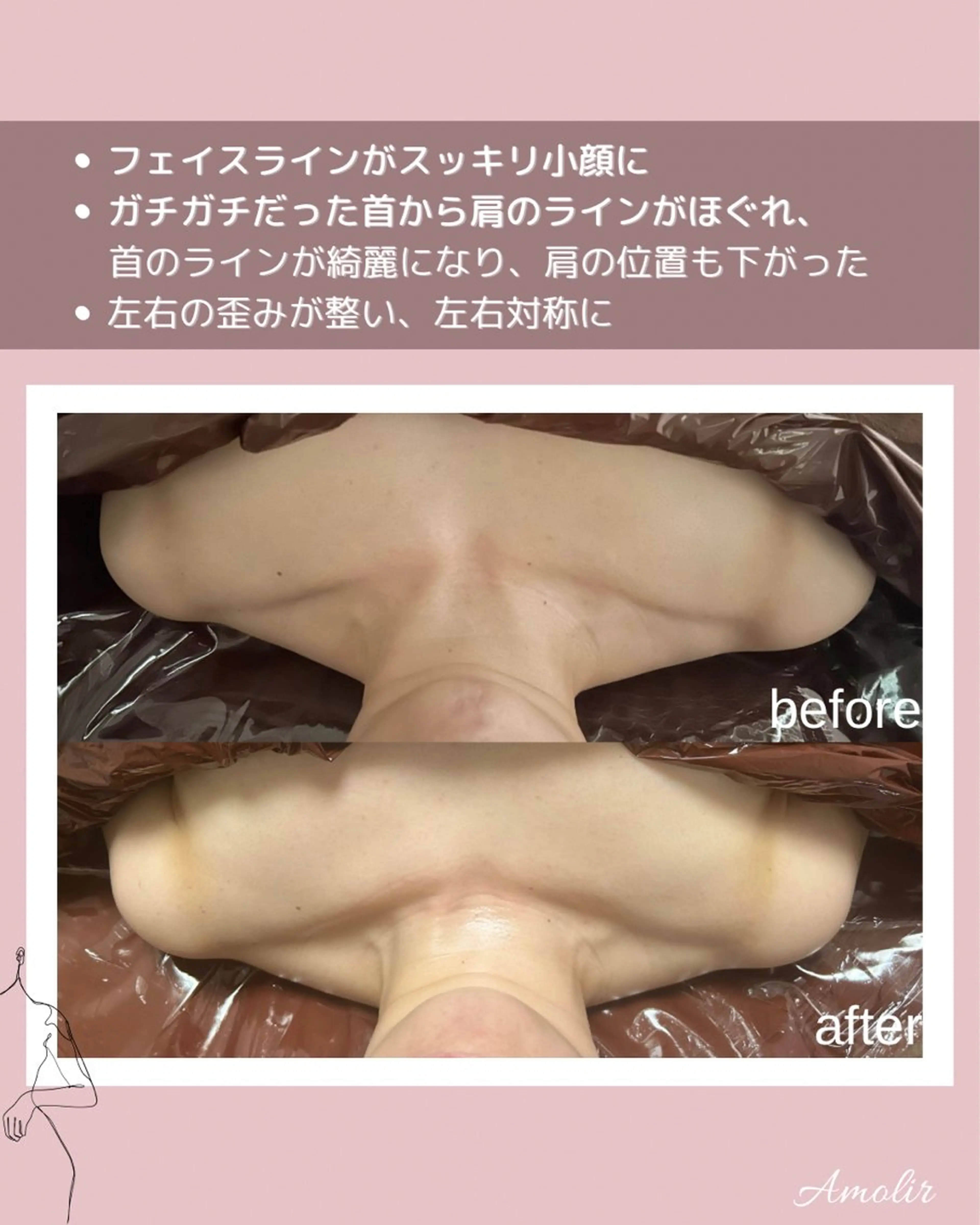 エステ リラク 30代以降のボディ メイク Amolirのエステ・リラクイメージ