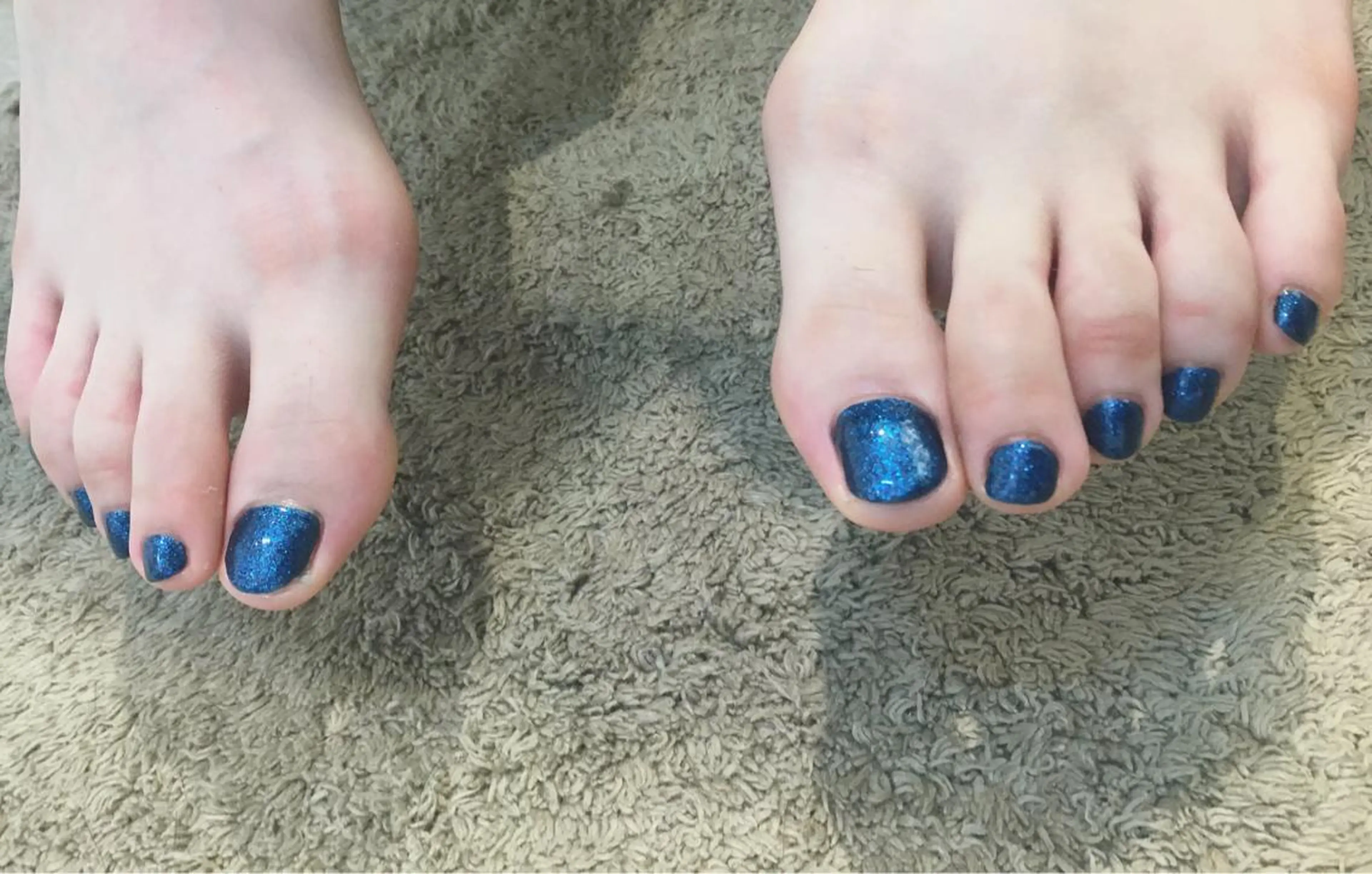 ネイル フットネイル JurerEye☆ Marikoのネイルデザイン