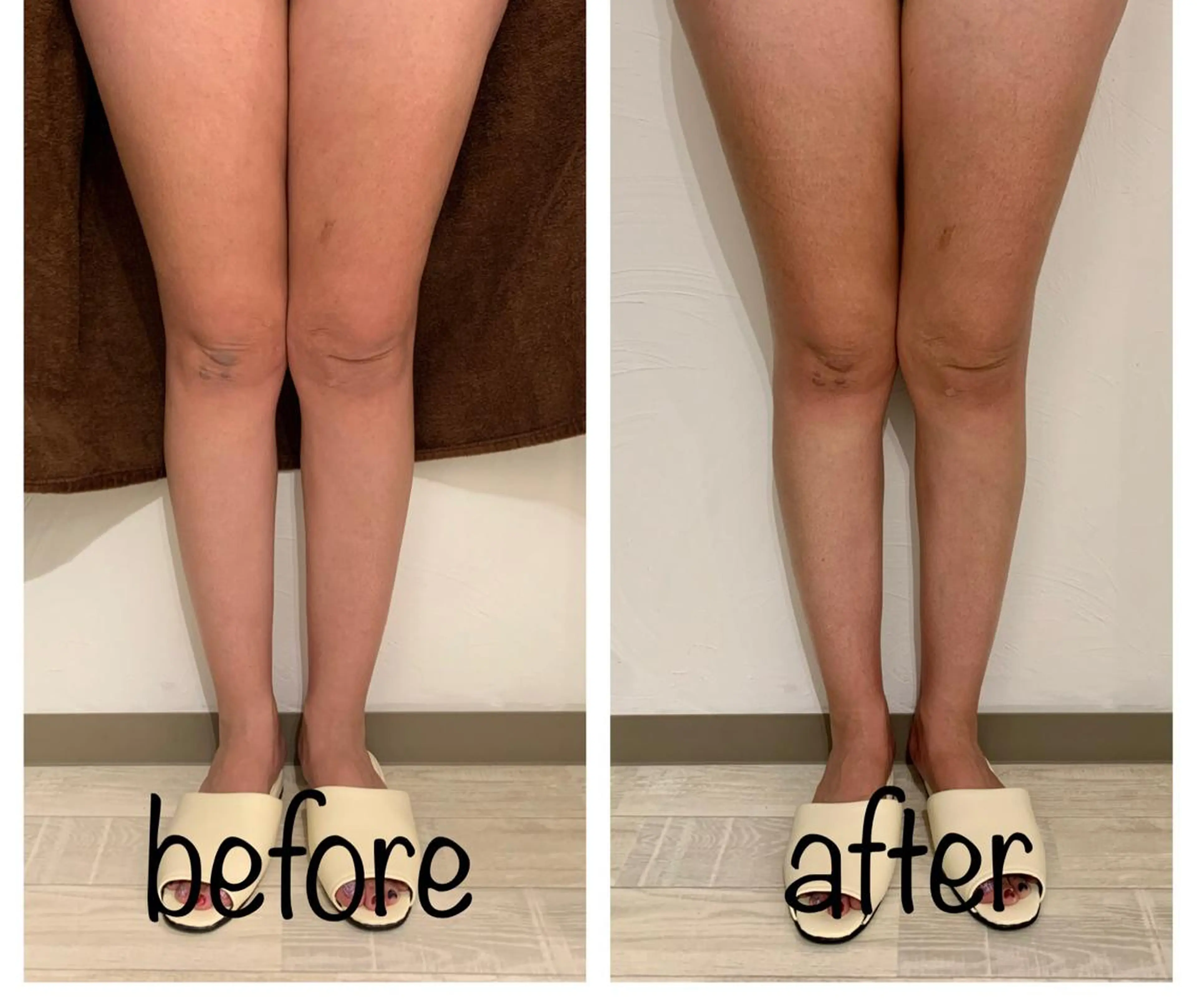 リンパマッサージ&ピラティスmimoza所属・リンパマッサージ mimozaのエステ・リラクイメージ