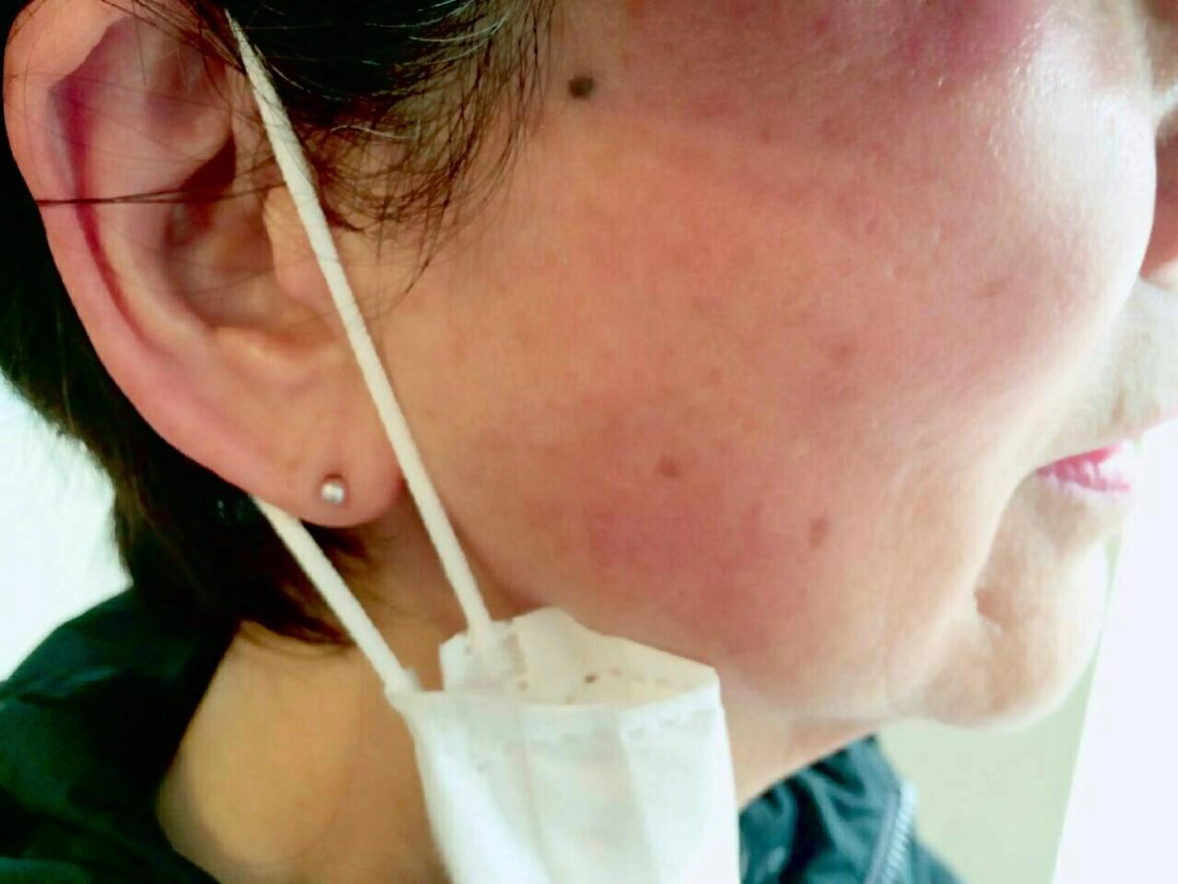 HappIness 遠赤外線ドームのエステ・リラクイメージ