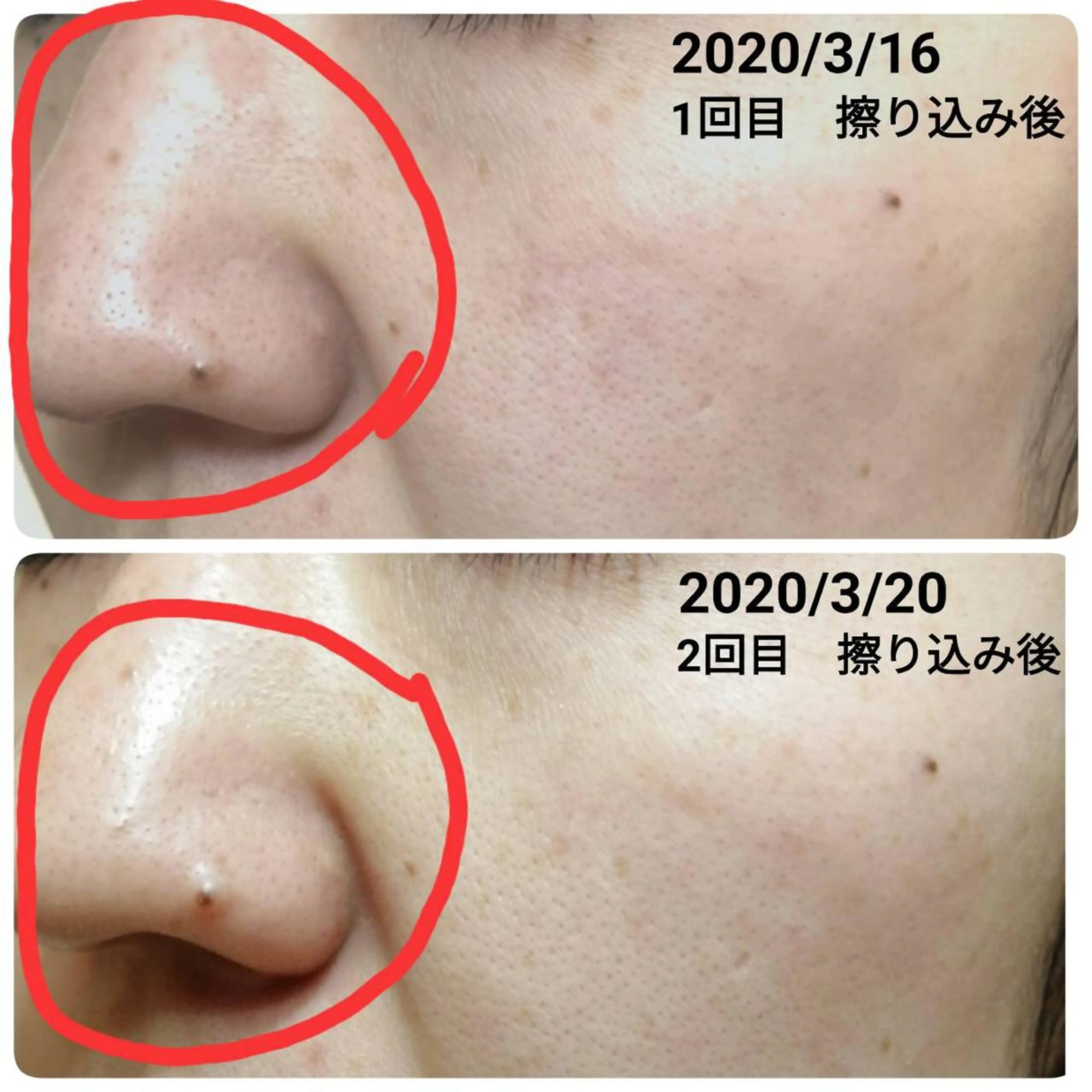 未病ケアサロン　EMINY所属・未病ケアサロン EMINY☺︎勝俣のエステ・リラクイメージ