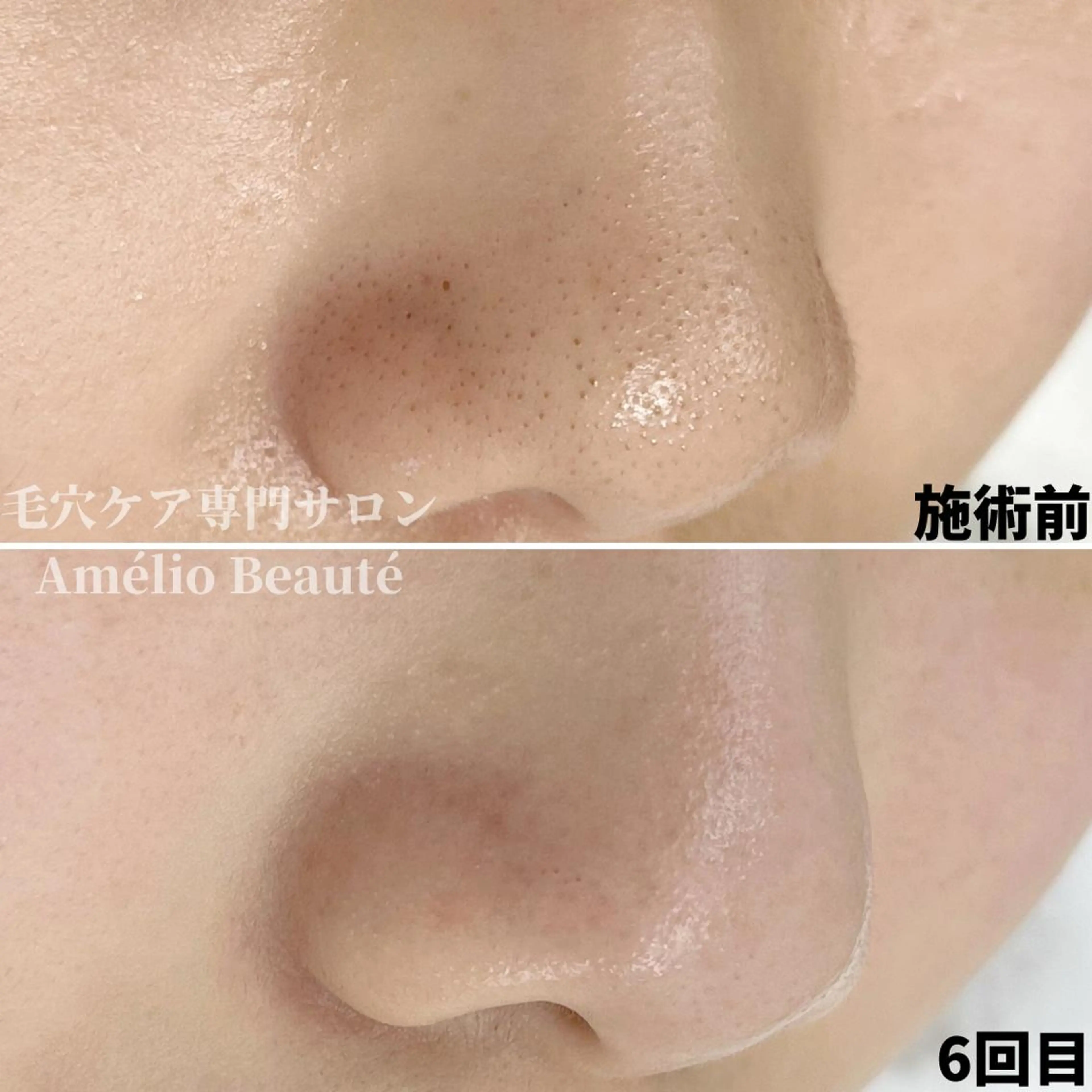 毛穴ケア専門サロン Amélio Beauté所属・毛穴ケア専門サロン アメリオボーテのその他イメージ