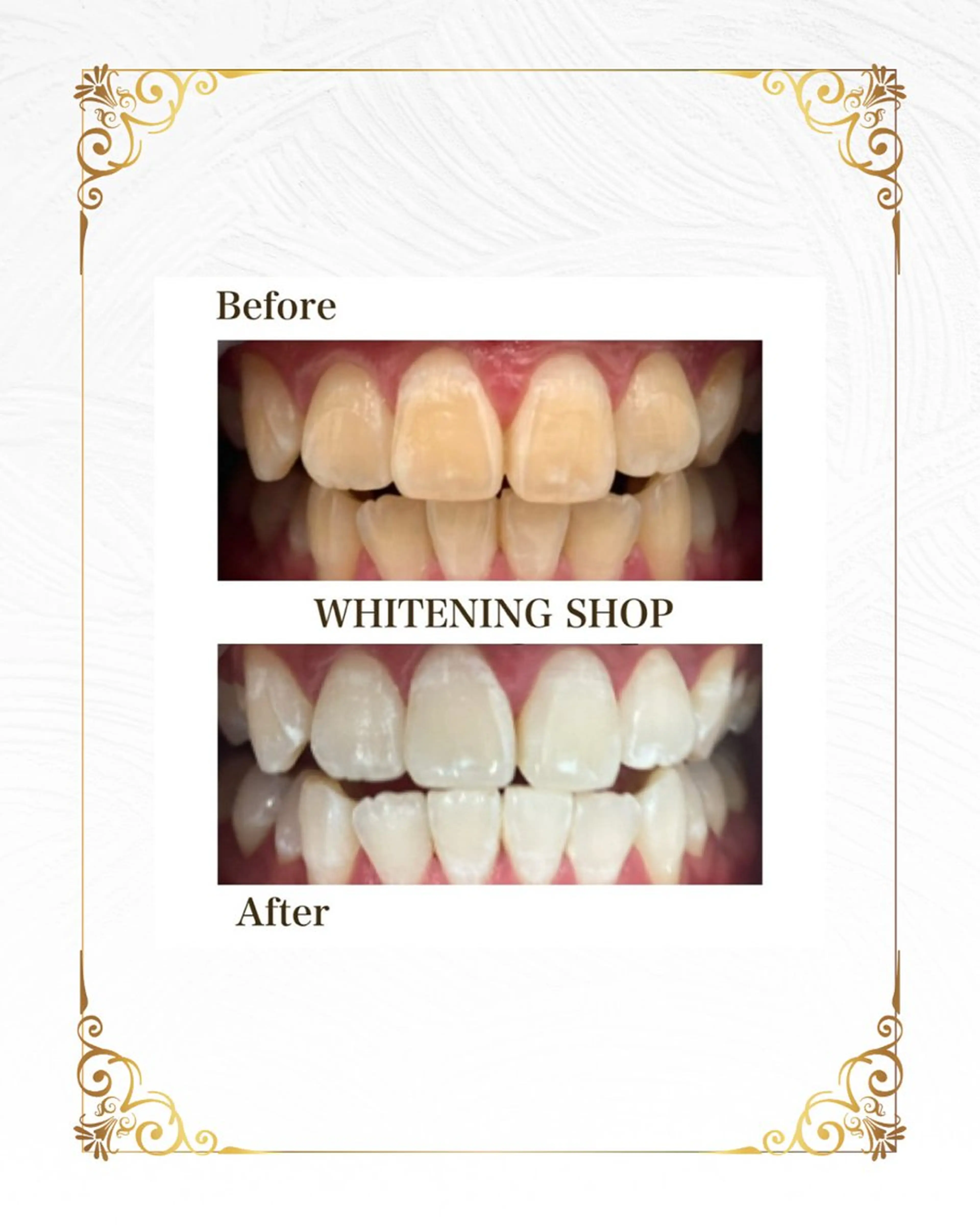 その他 ホワイトニングショップ静岡葵区店所属・ホワイトニング ショップ静岡葵区店のその他イメージ