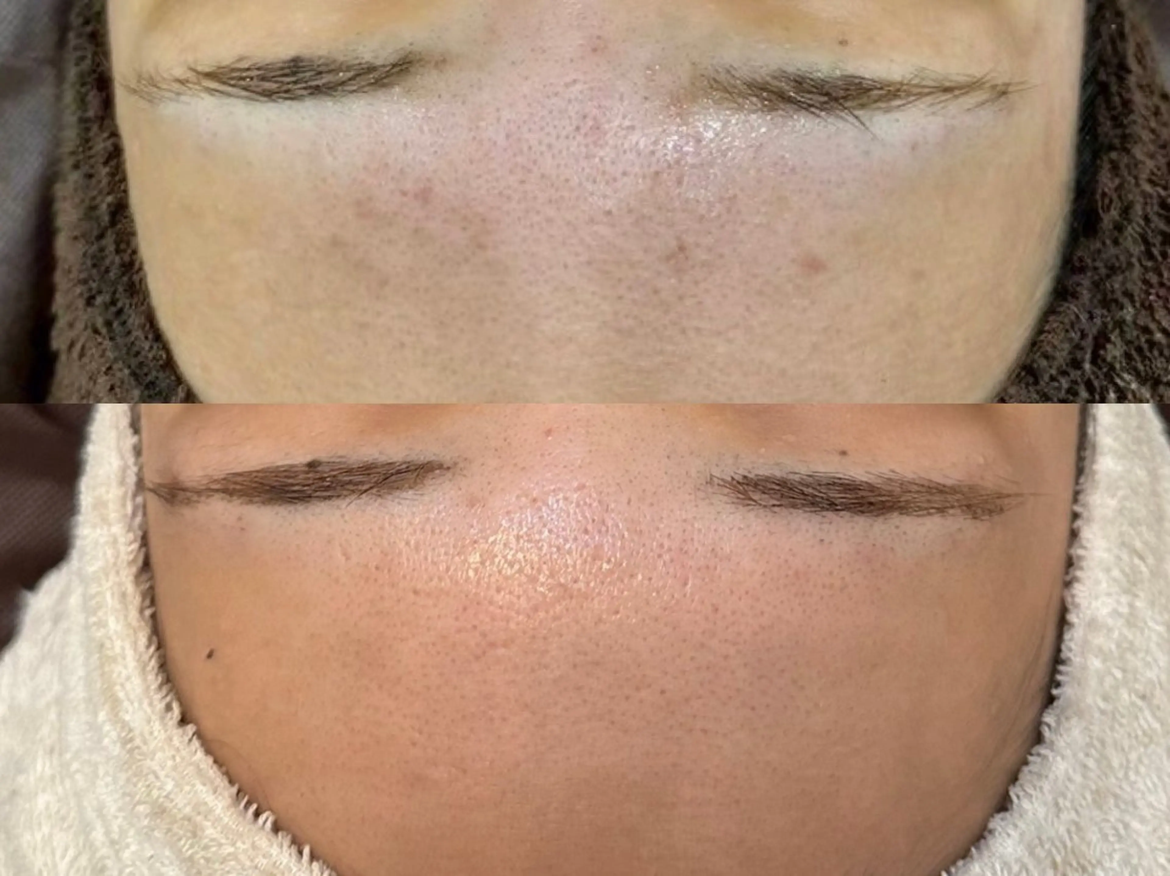 【ハーブスペシャル】1番人気！オーダーメイド幹細胞ハーブ¥26.400→の写真