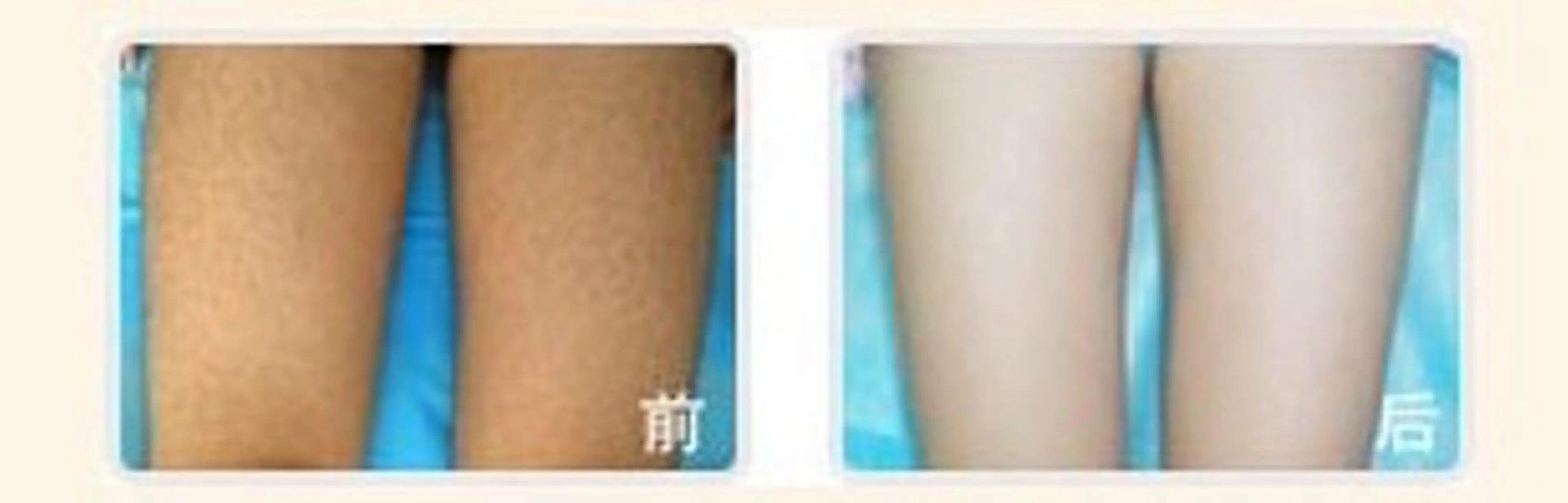 脱毛 aliaハイフ&水光ジェットサロン所属・aliaハーブ水光店 エステティシャン募集のエステ・リラクイメージ