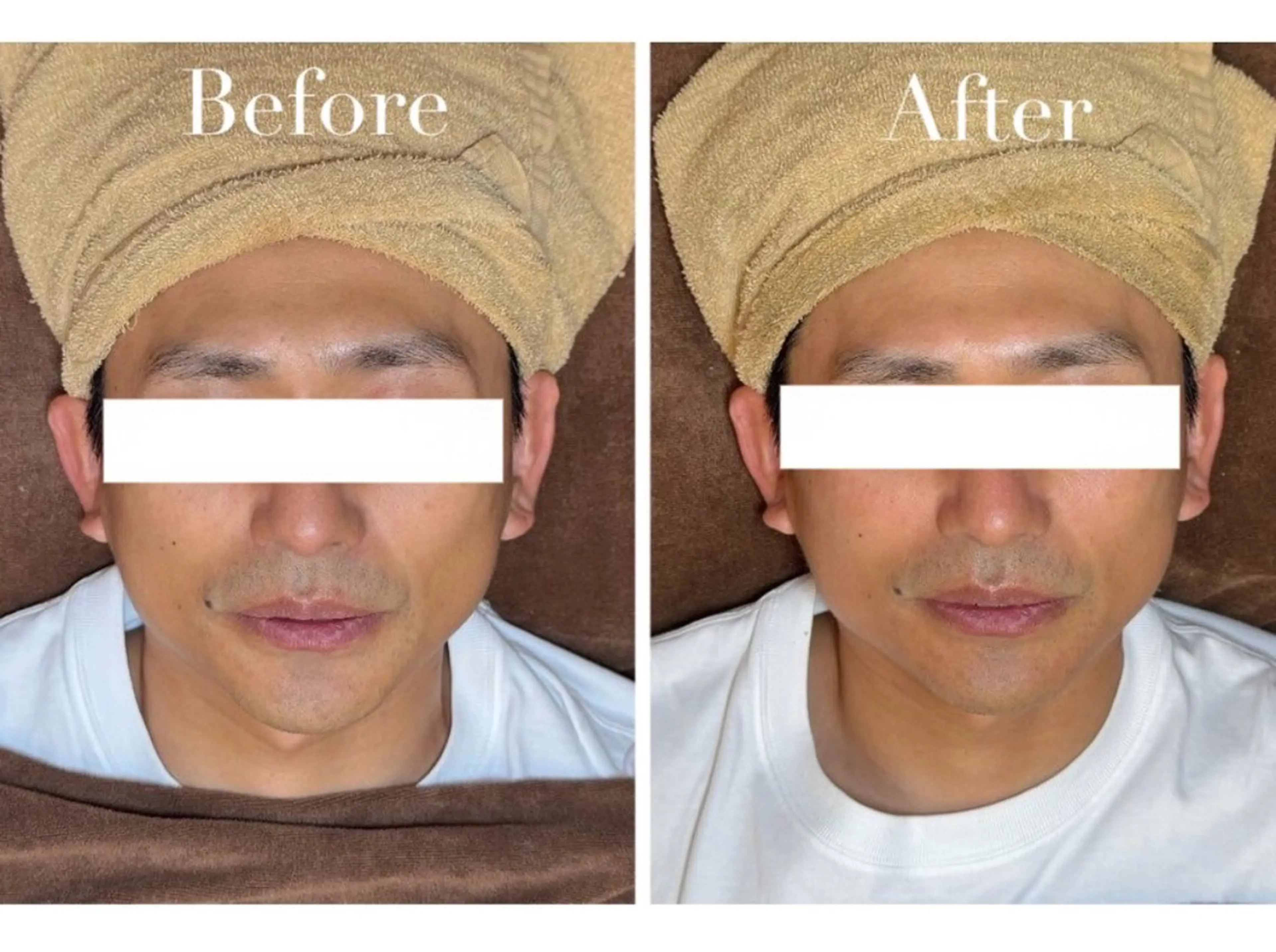 エステ Avenir Brillant所属・松田 紗季のエステ・リラクイメージ