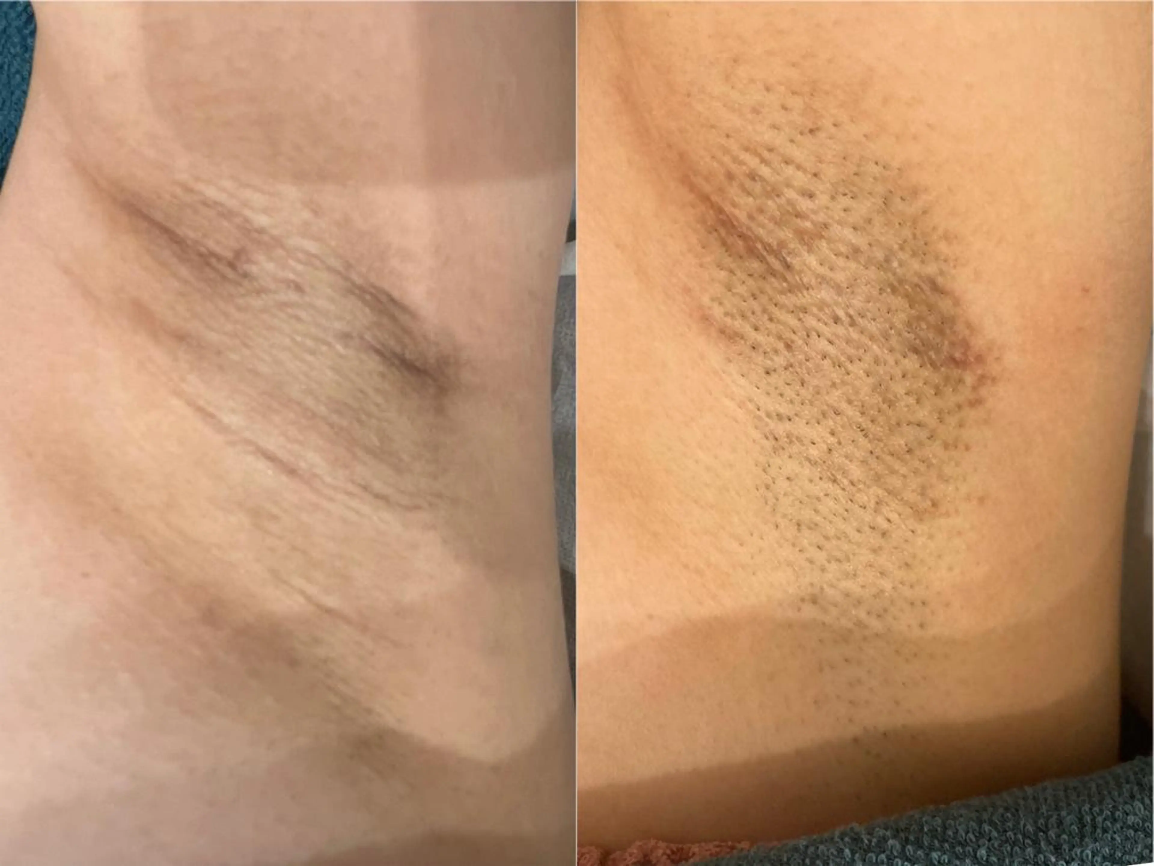 Le cherien所属・Le cherien ルシェリアのエステ・リラクイメージ