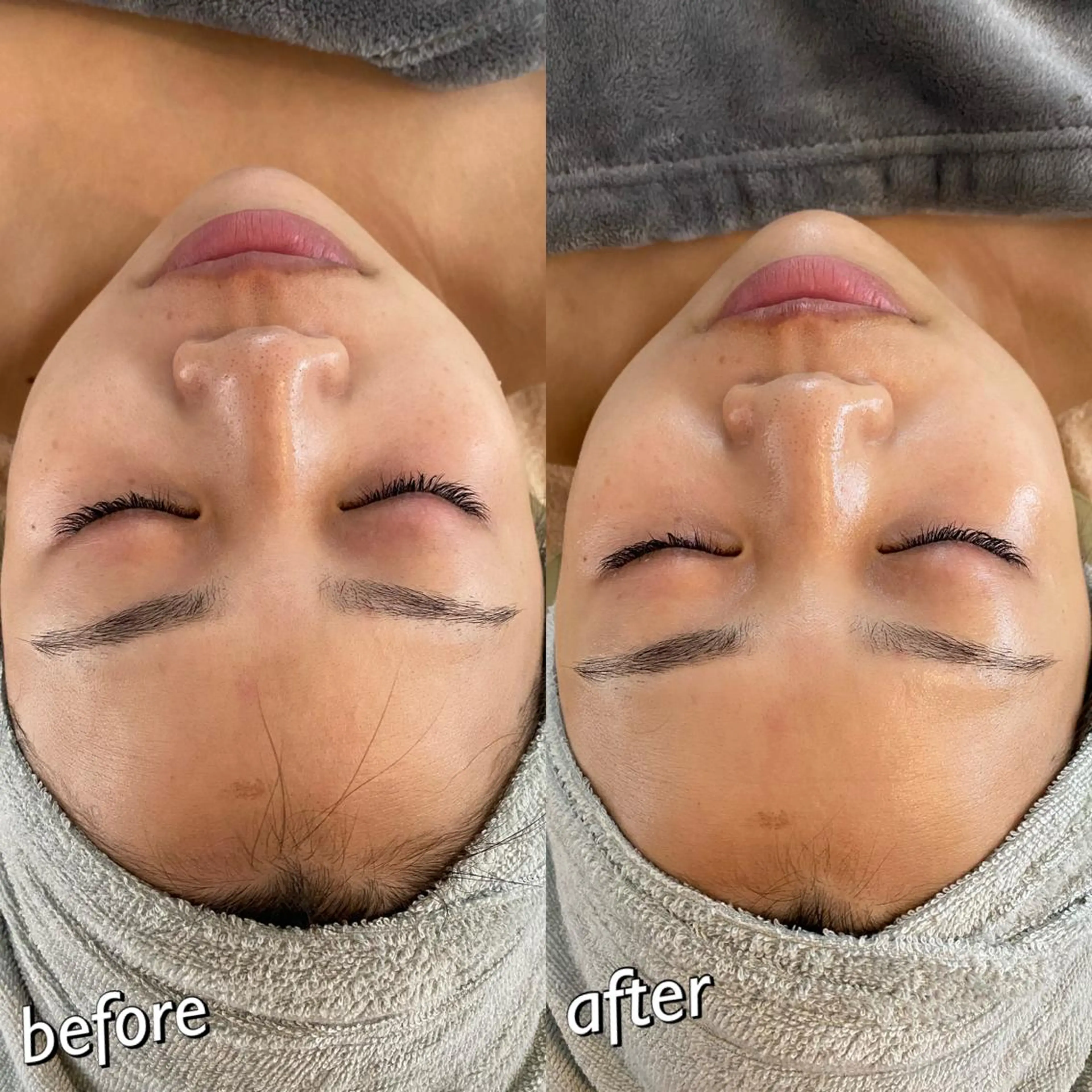 うなじ脱毛/美肌脱毛 LABELのエステ・リラクイメージ