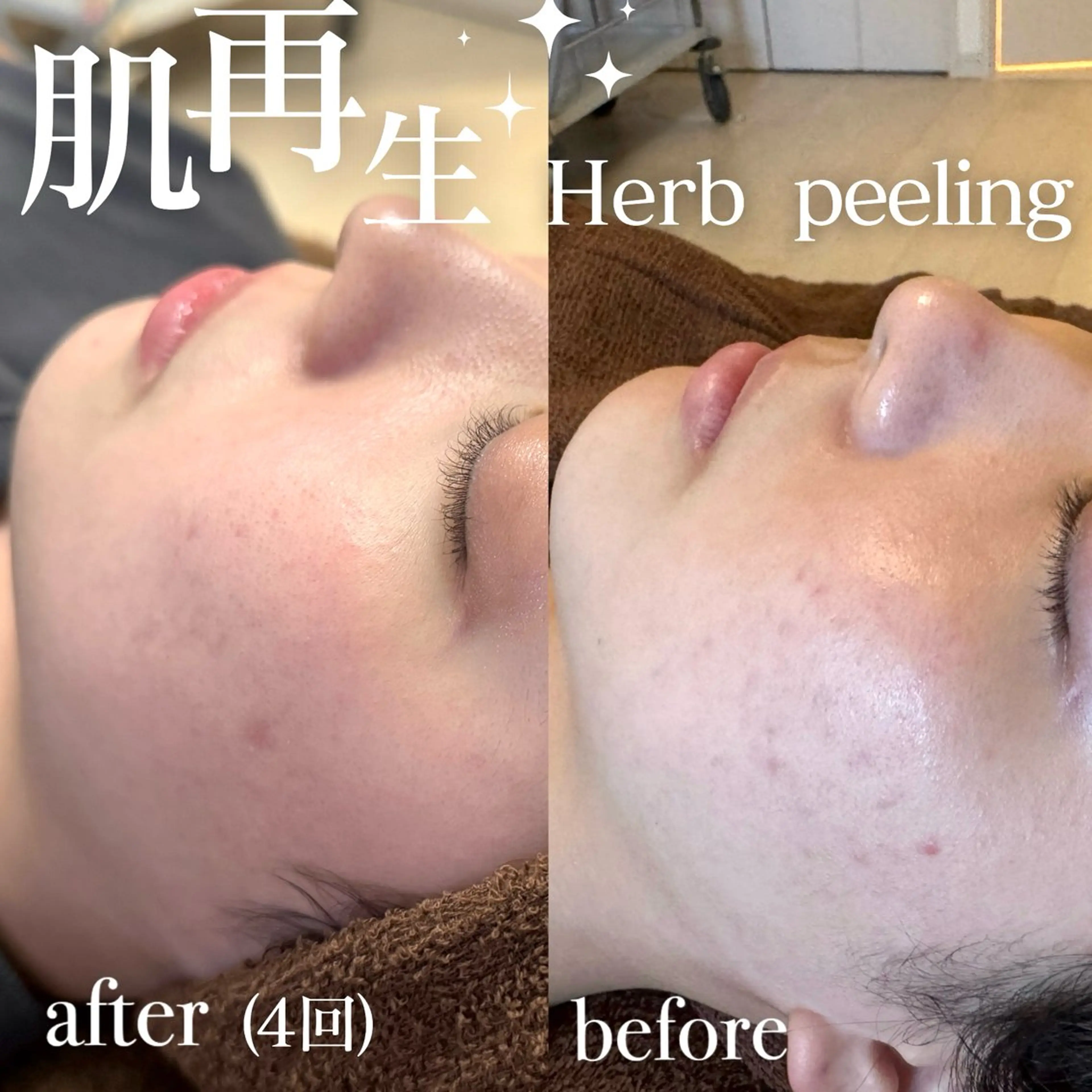 エステ 美肌salon GRAN CUORE所属・Natsuki🌙 GRAN CUOREのエステ・リラクイメージ