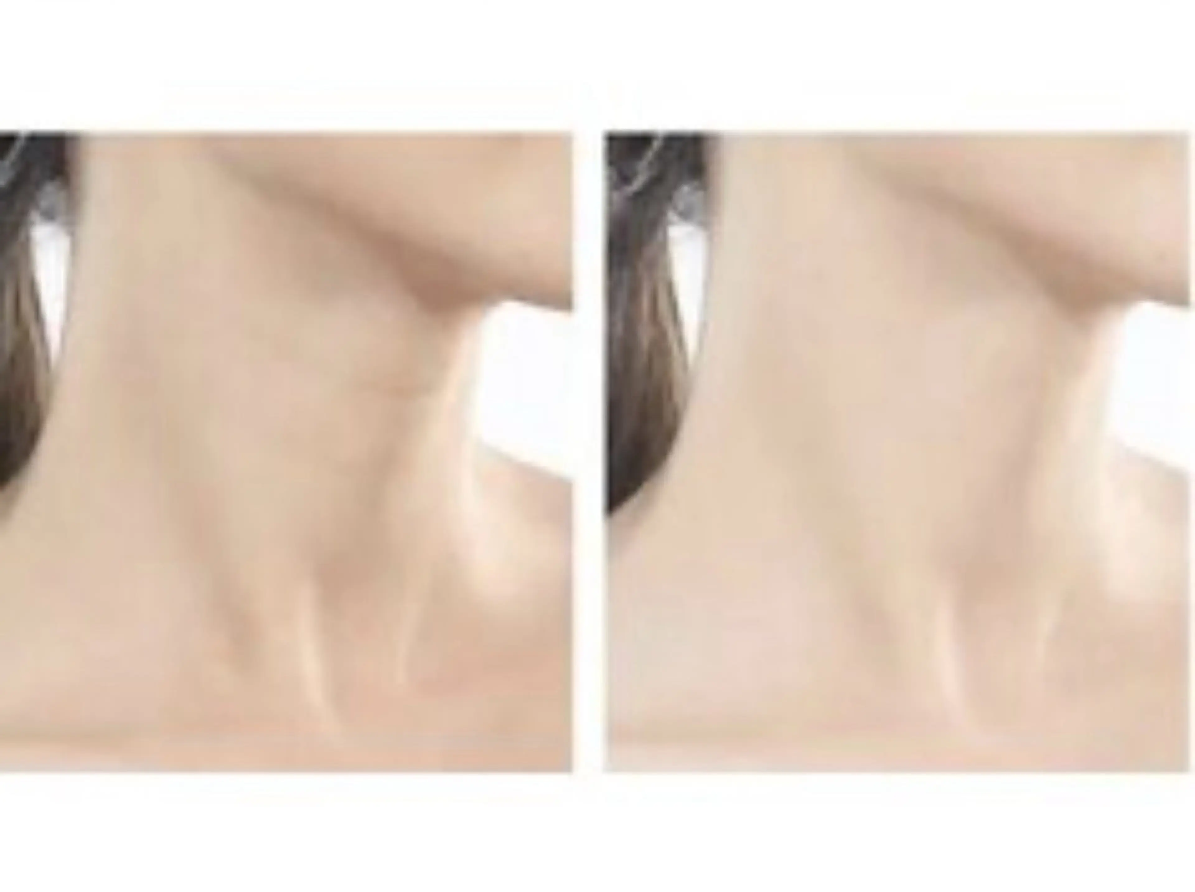 ☆最新7Dビューティー首のたるみケア、お悩み解消！仕上げ後若々しく印象へ♪の写真