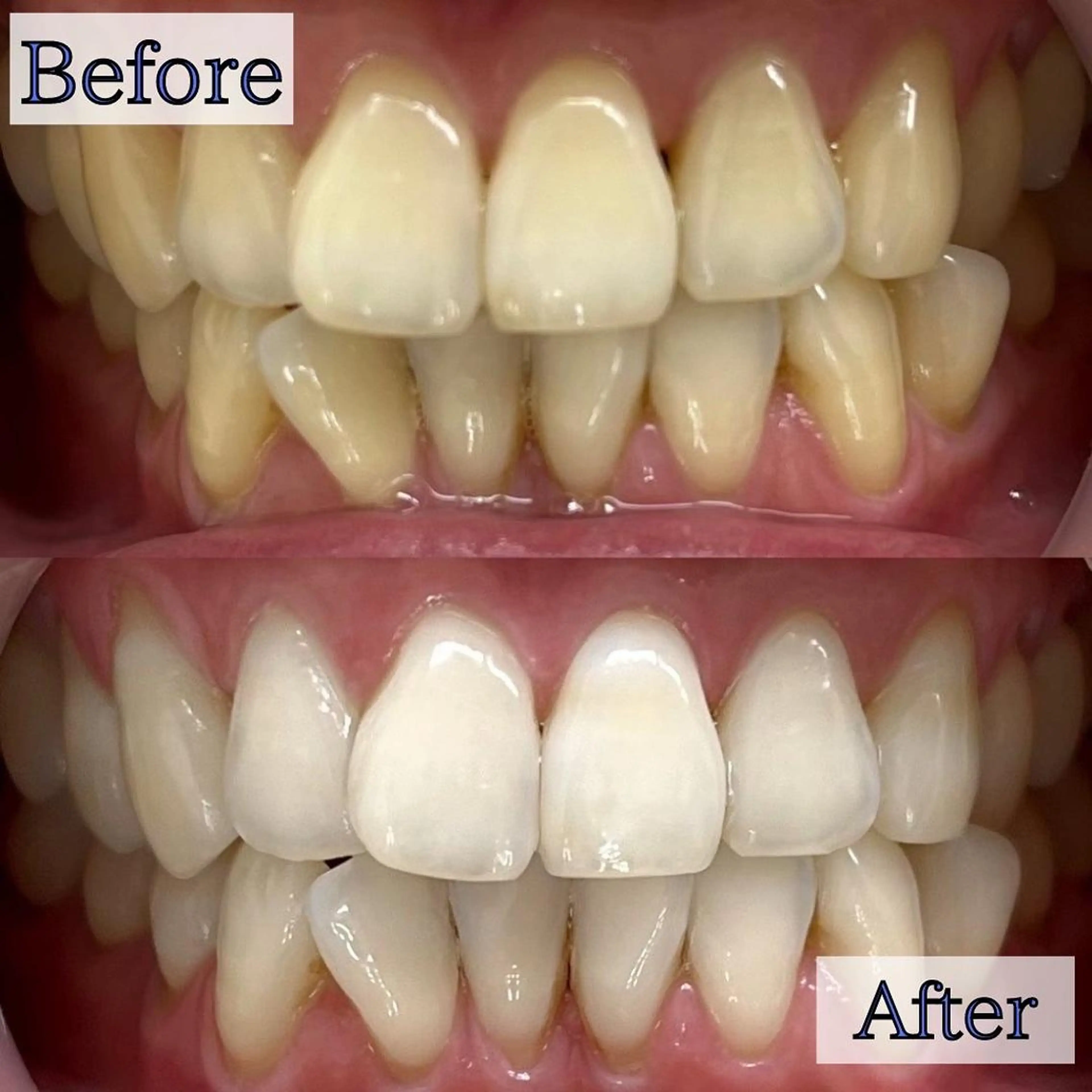 LBSホワイトニング 銀座店💎スタッフ峯のその他イメージ