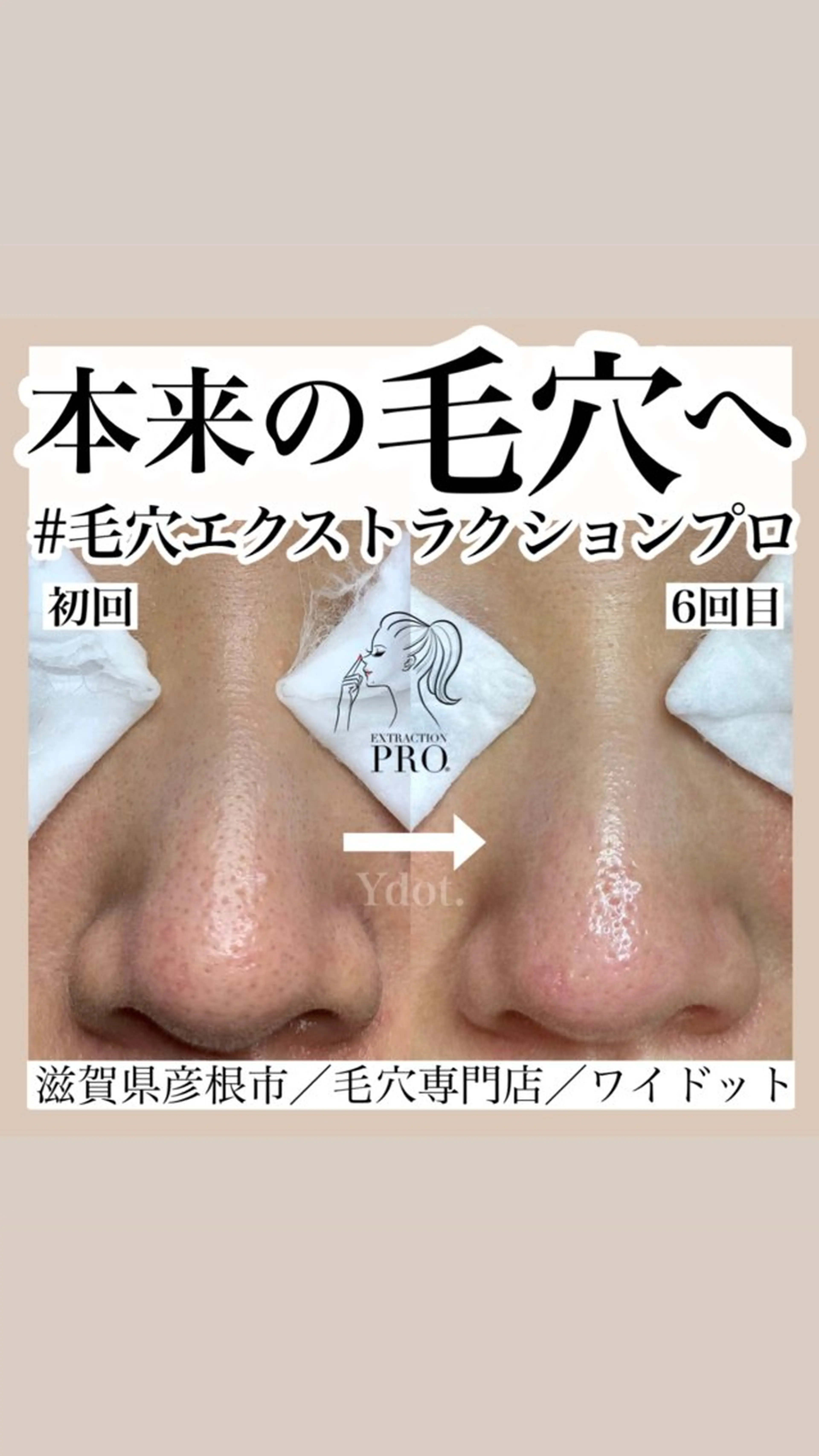 毛穴スッキリ美肌コースの写真