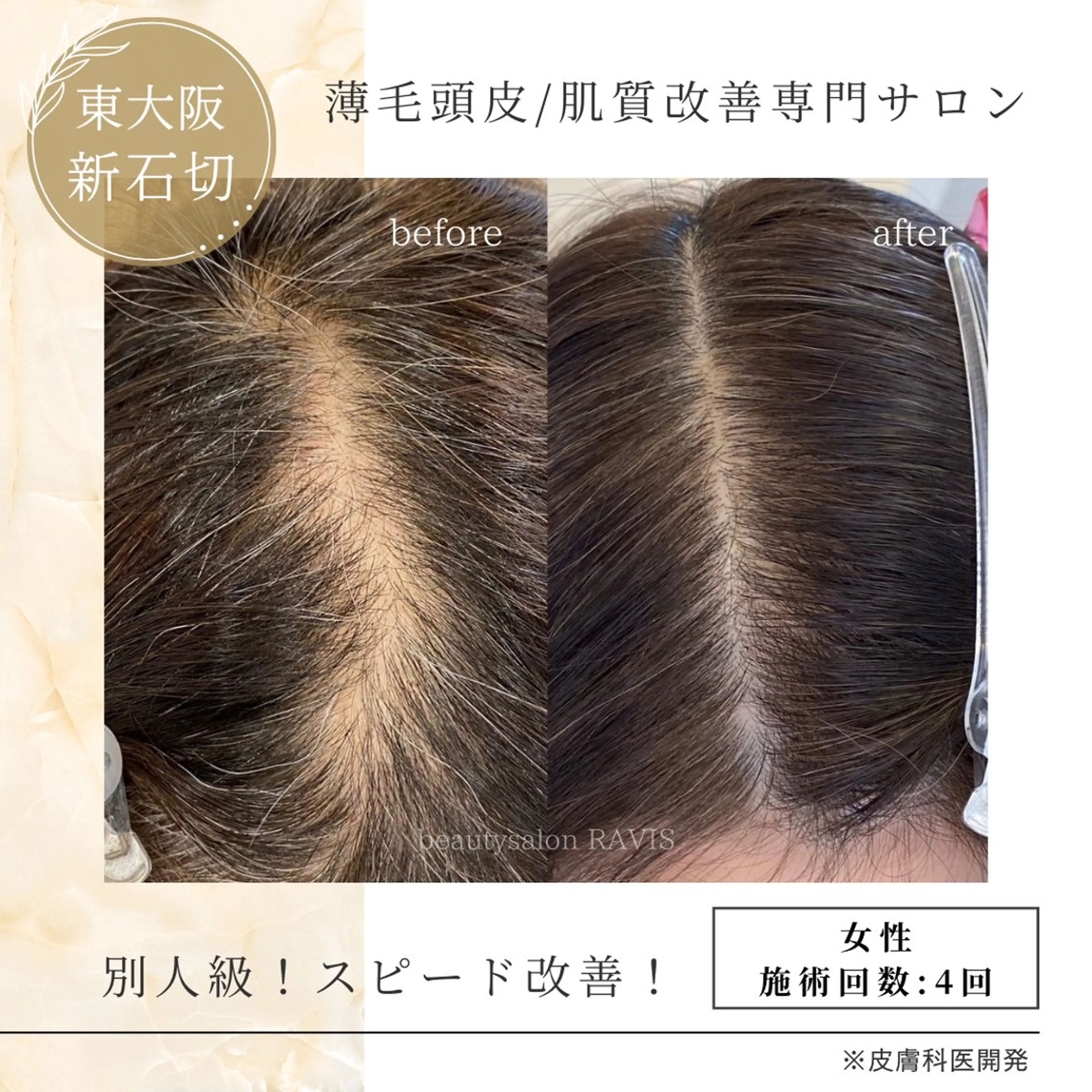 新石切ravis - ラヴィス -のその他イメージ