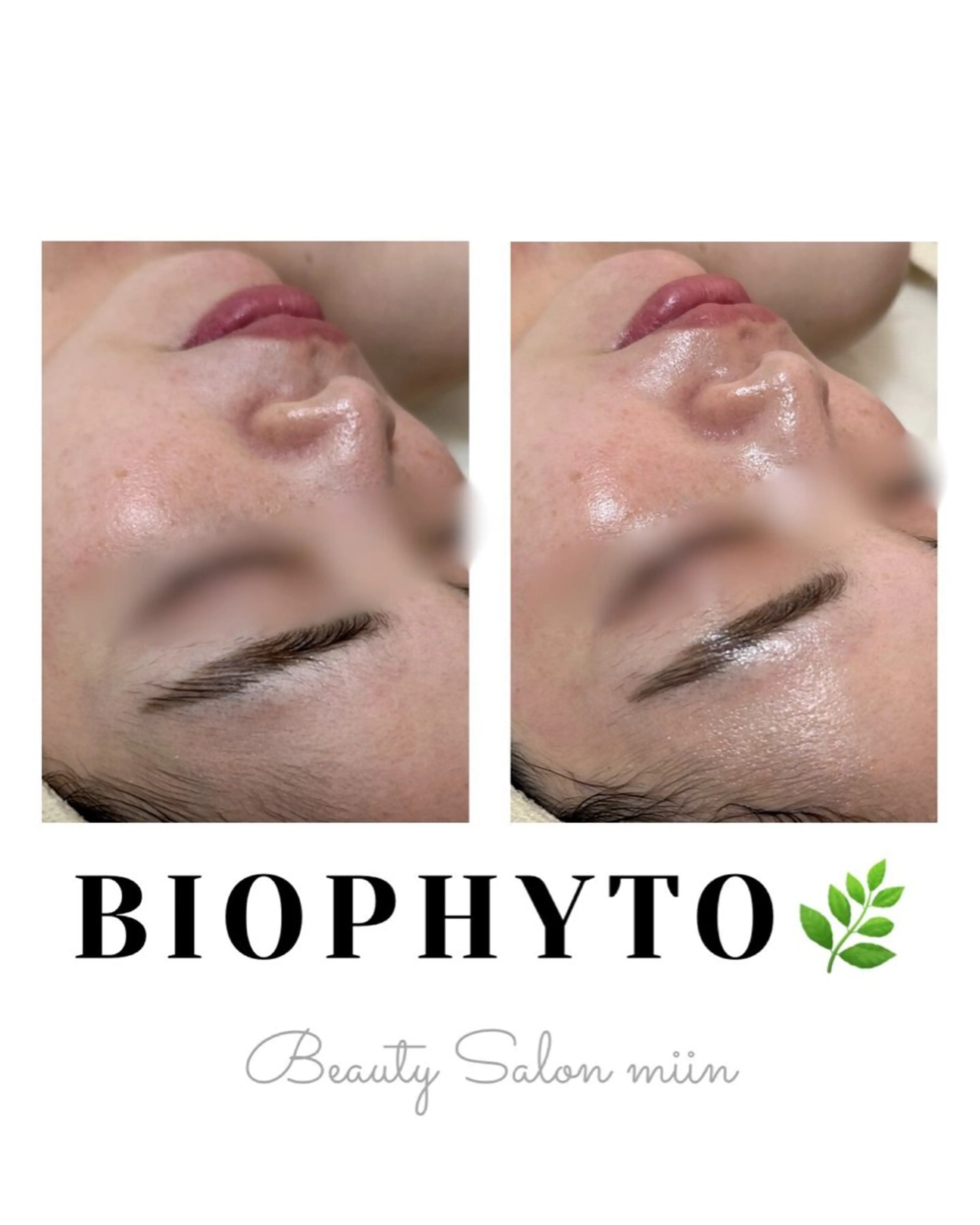 リラク 韓国肌管理 白玉肌管理®︎のエステ・リラクイメージ