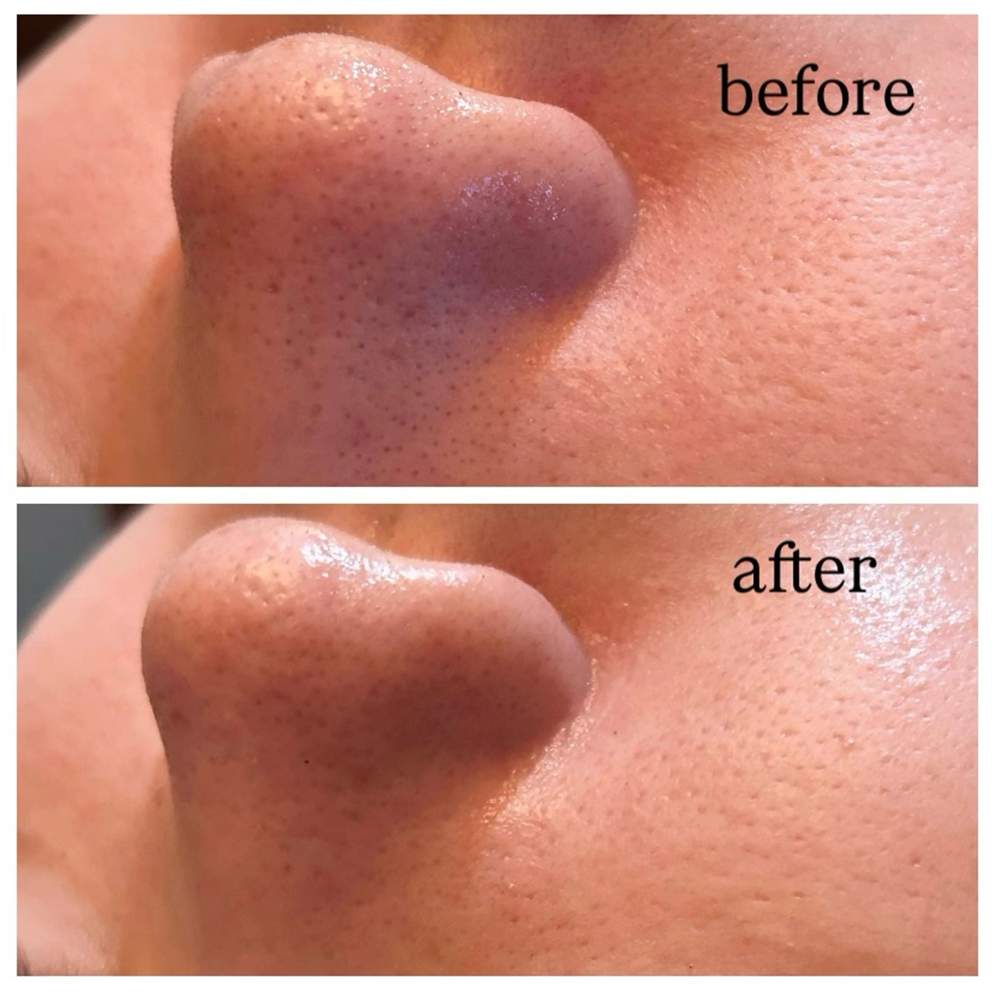 肌質改善専門 ハーブ /毛穴洗浄 リエイトのエステ・リラクイメージ