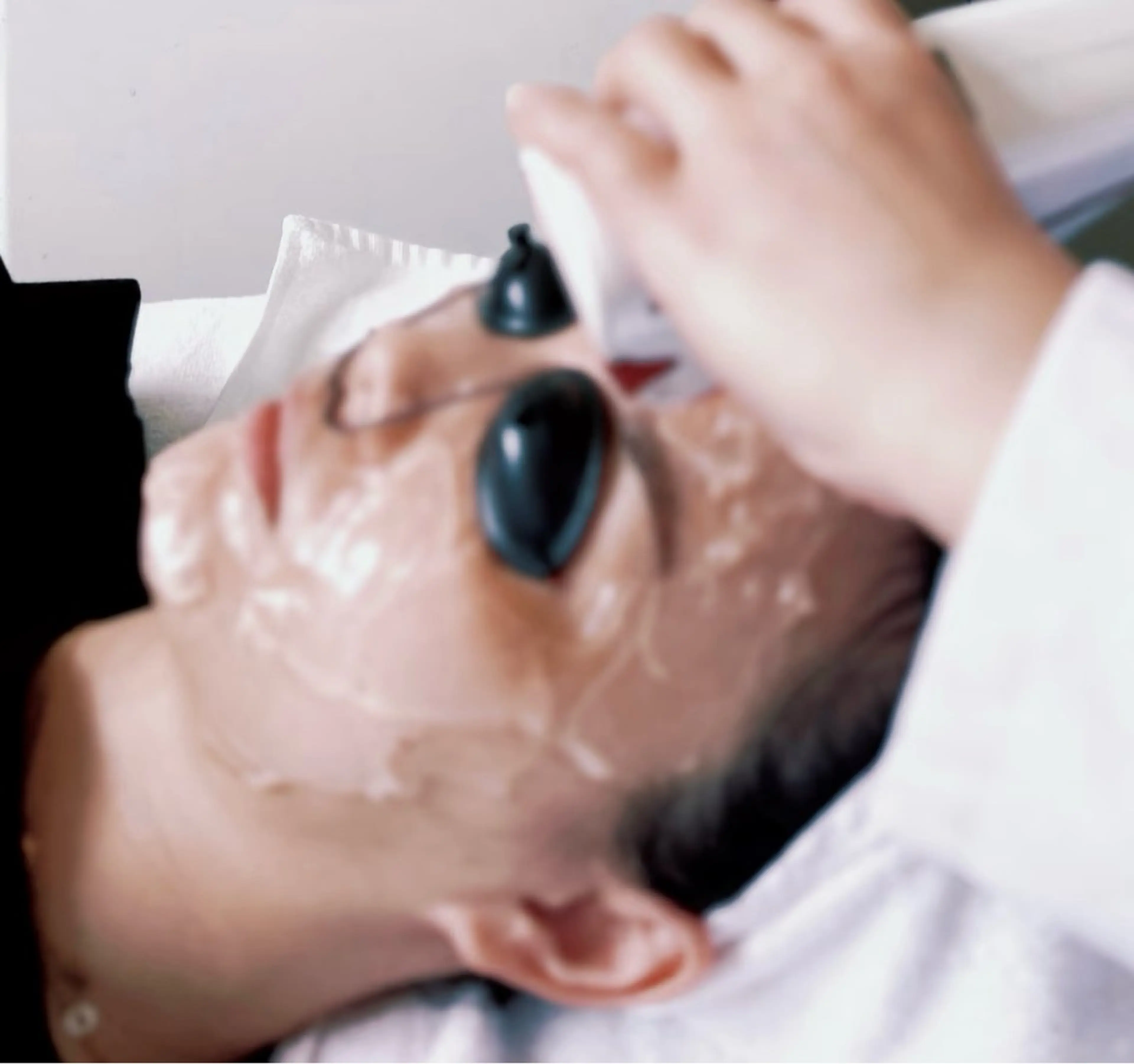 フォトシルクプラス【肌質改善】ダウンタイムなし！痛みの少ない肌質改善の写真