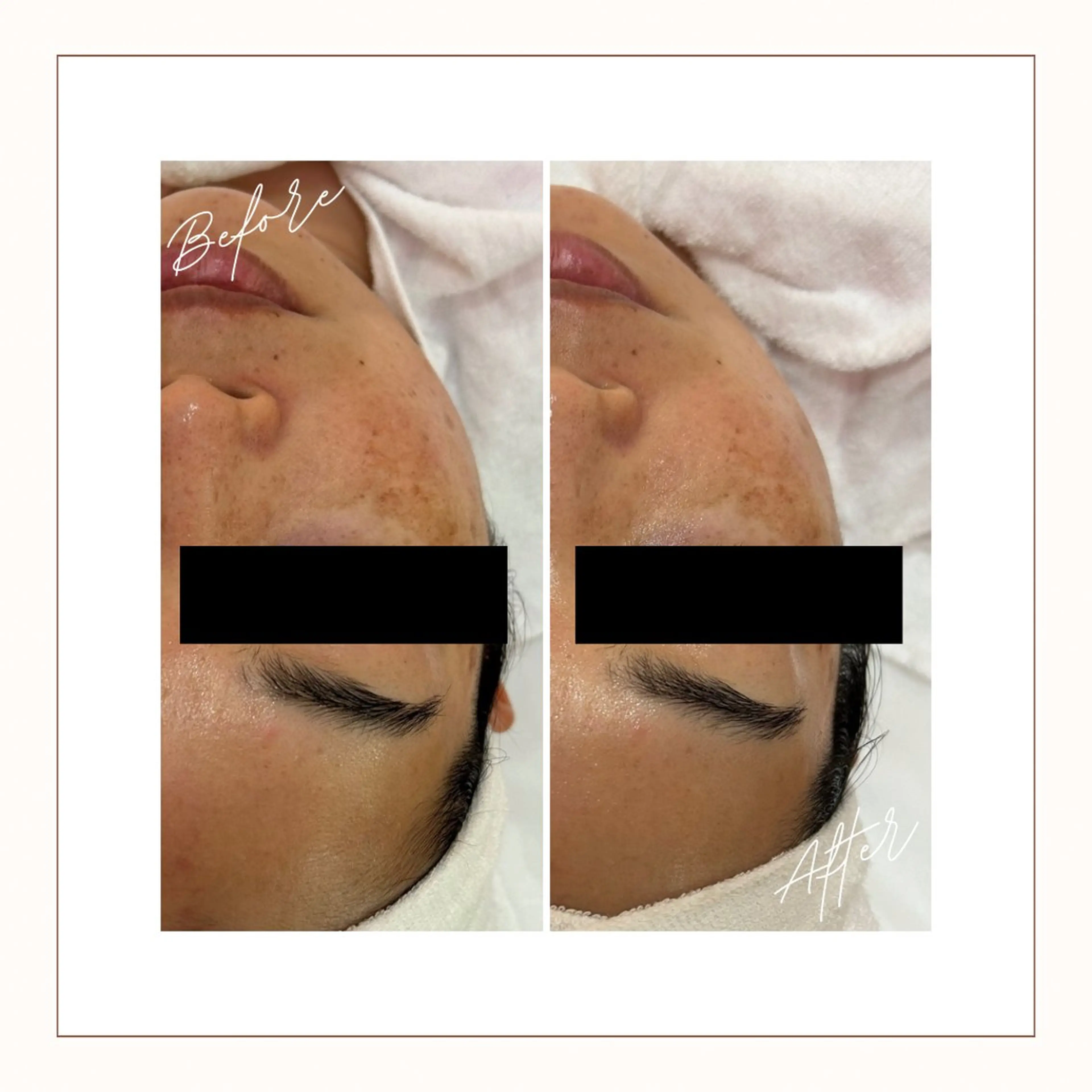 エステ ナリスビューティーステーションDe I'm岡山所属・小野 恵のエステ・リラクイメージ