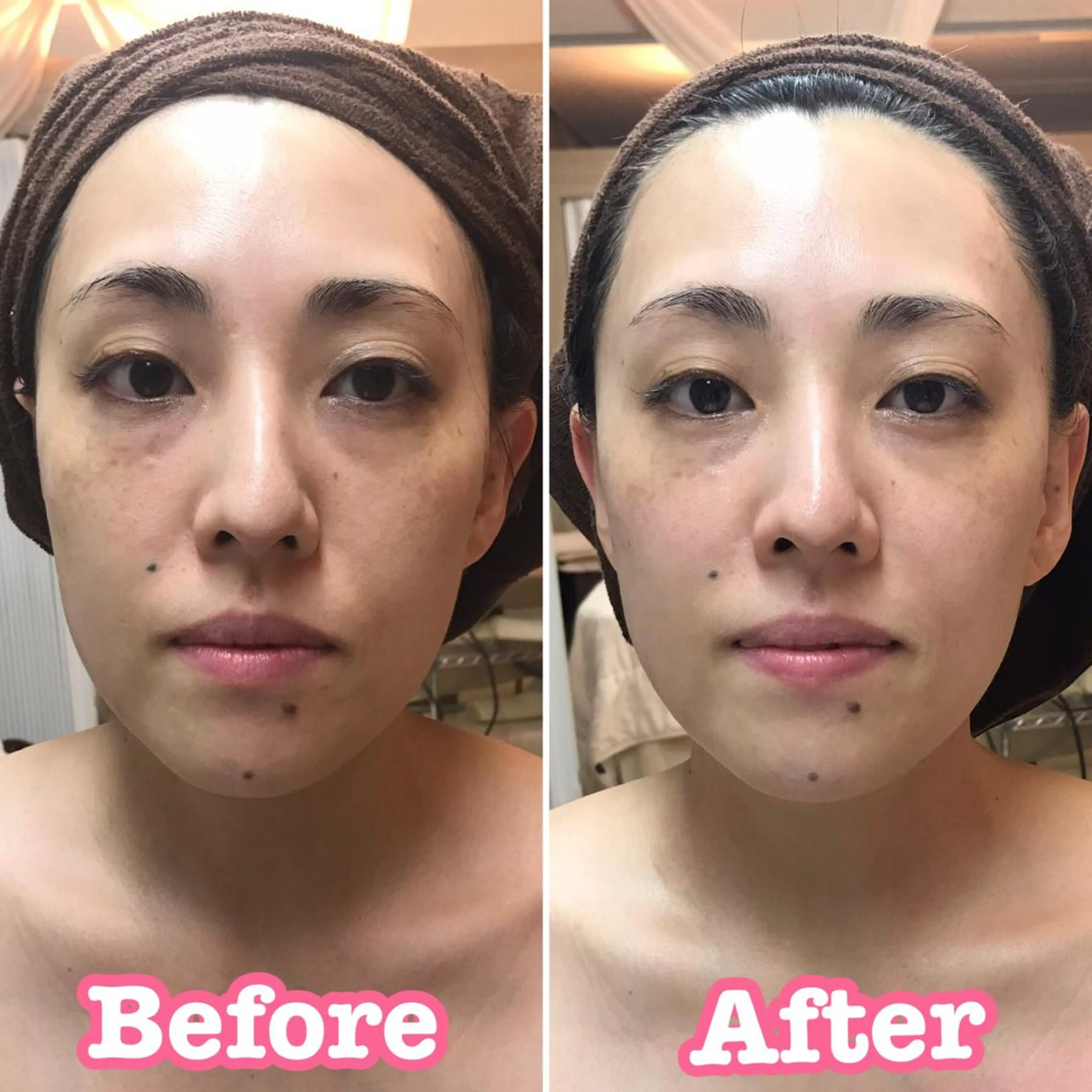 🥀エステティック レイビス横浜　永🥀のエステ・リラクイメージ