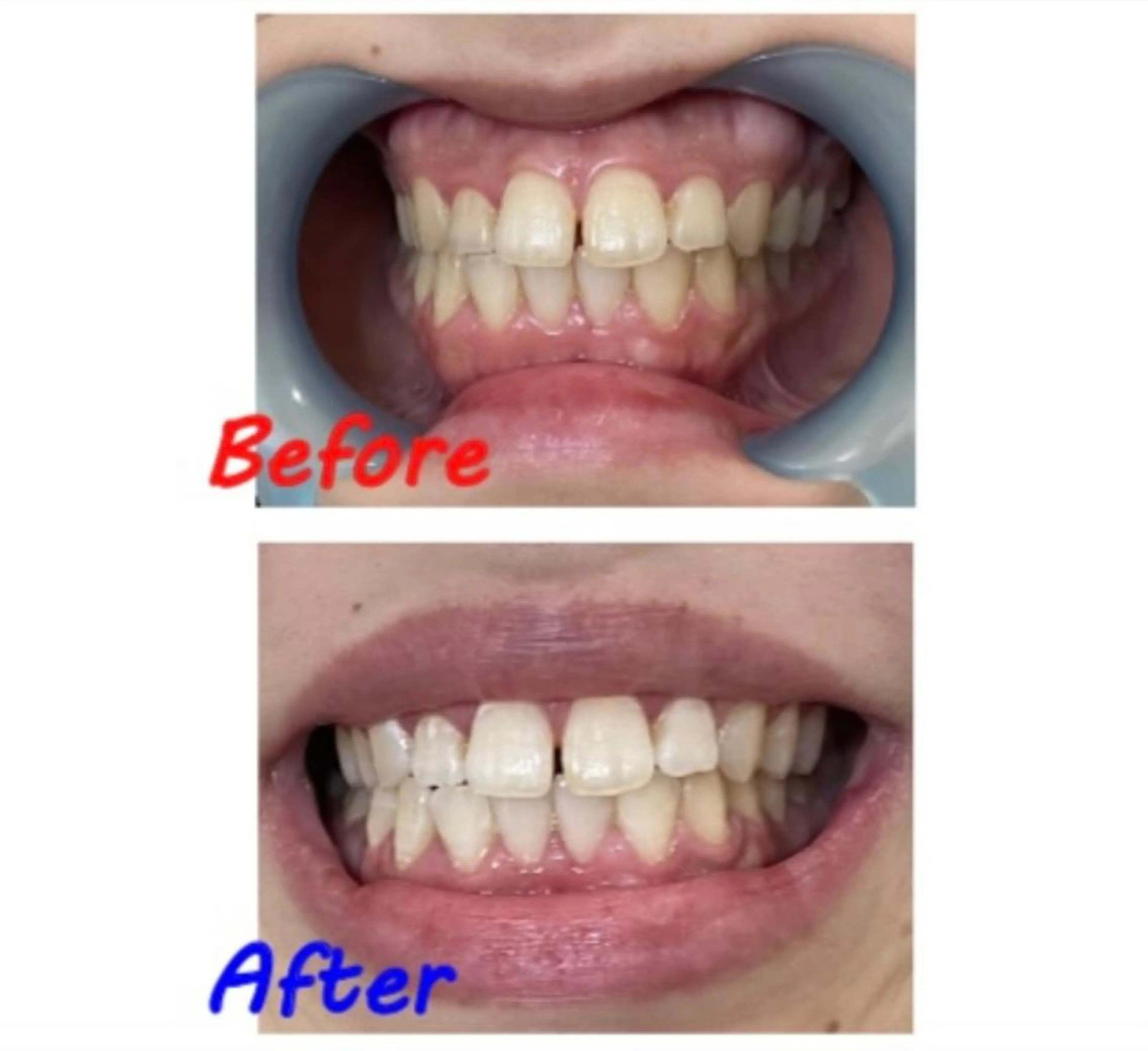 その他 セルフホワイトニングサロン　ラヴィアン所属・ホワイトニングサロン La vie enのその他イメージ