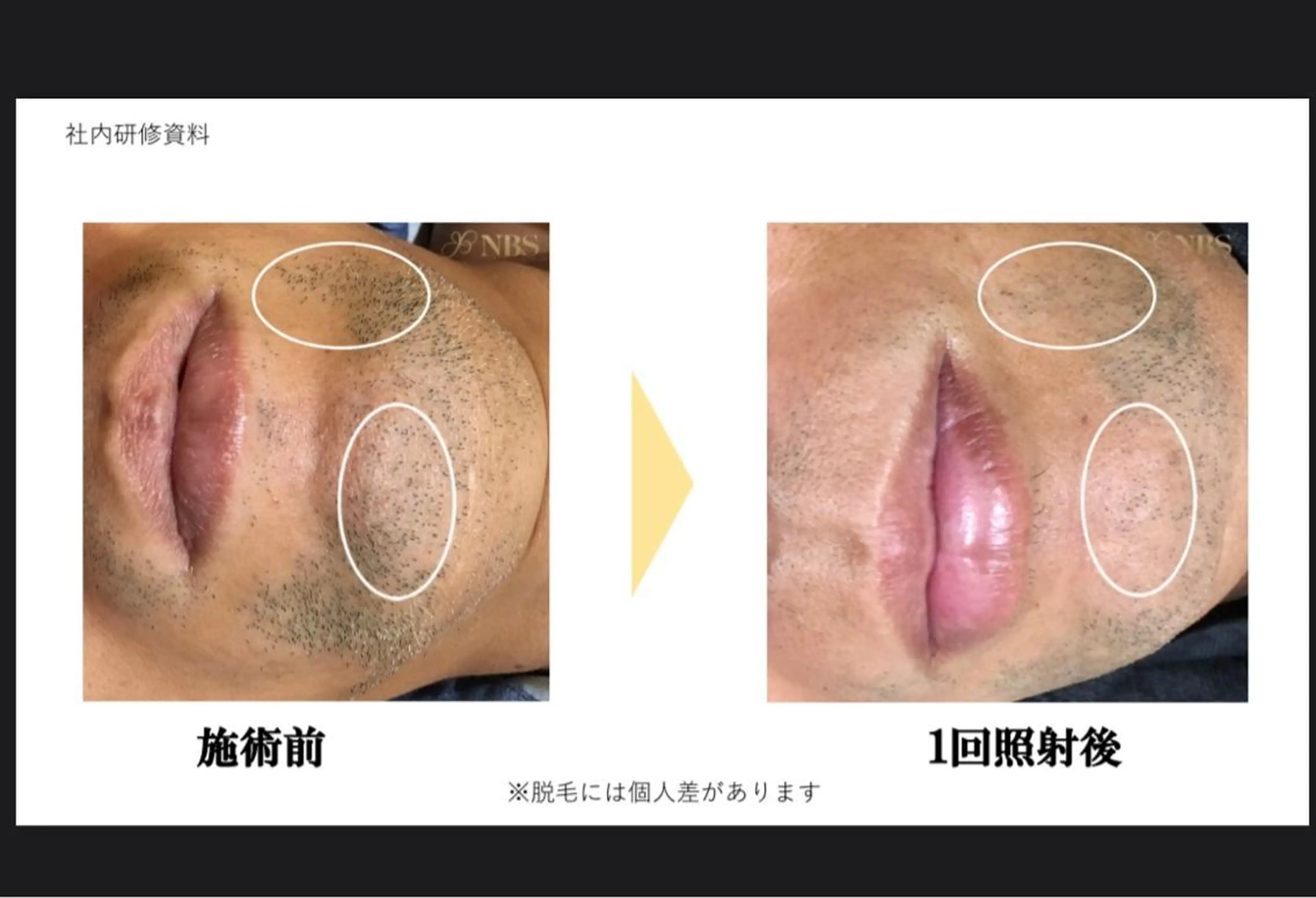 Nail &Beauty Salon ☆Kirari☆所属・ビューティサロン ☆Kirari☆のネイルデザイン