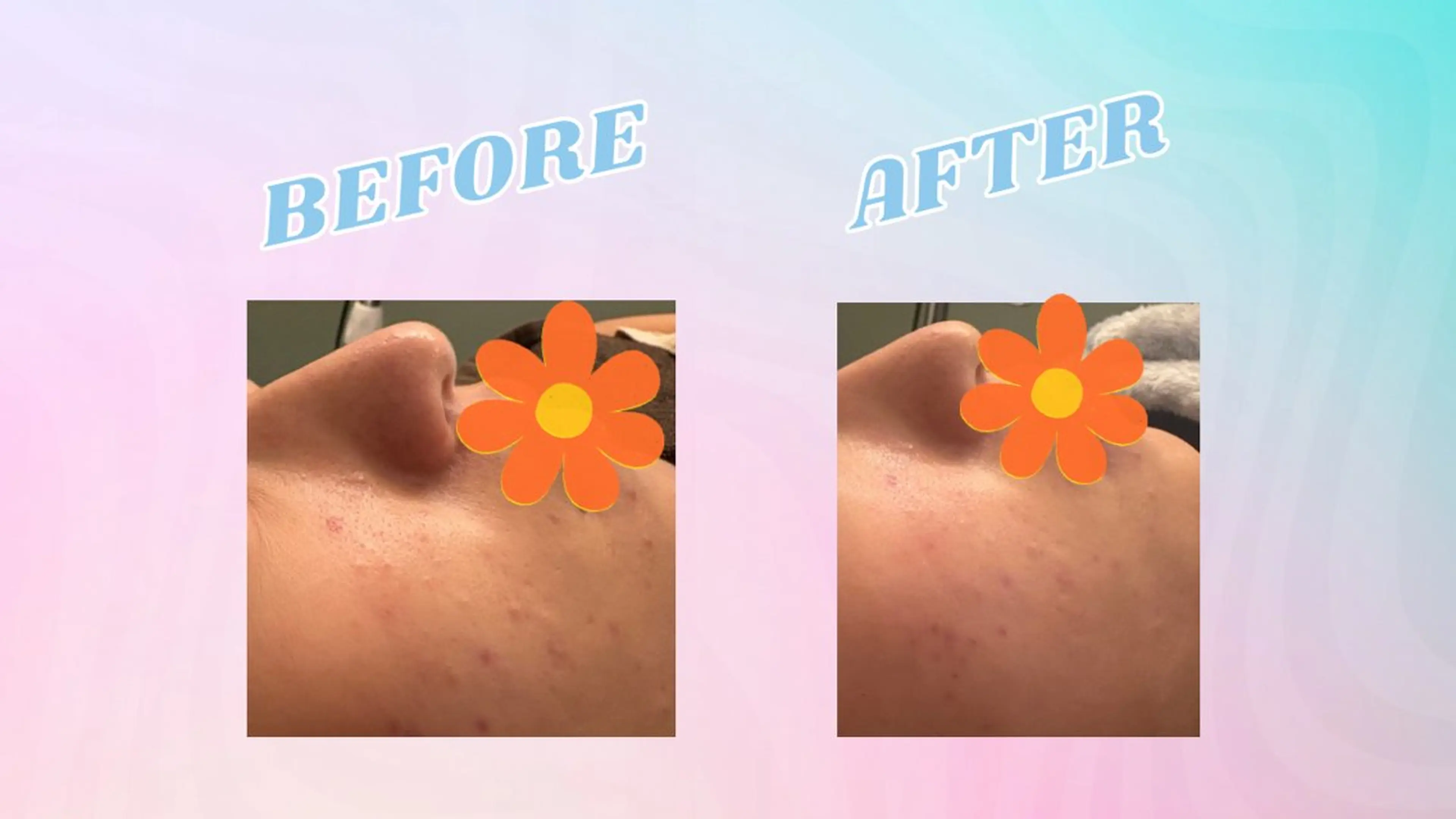 POWER OF BEAUTY所属・🎀TOMO🎀 “””のエステ・リラクイメージ