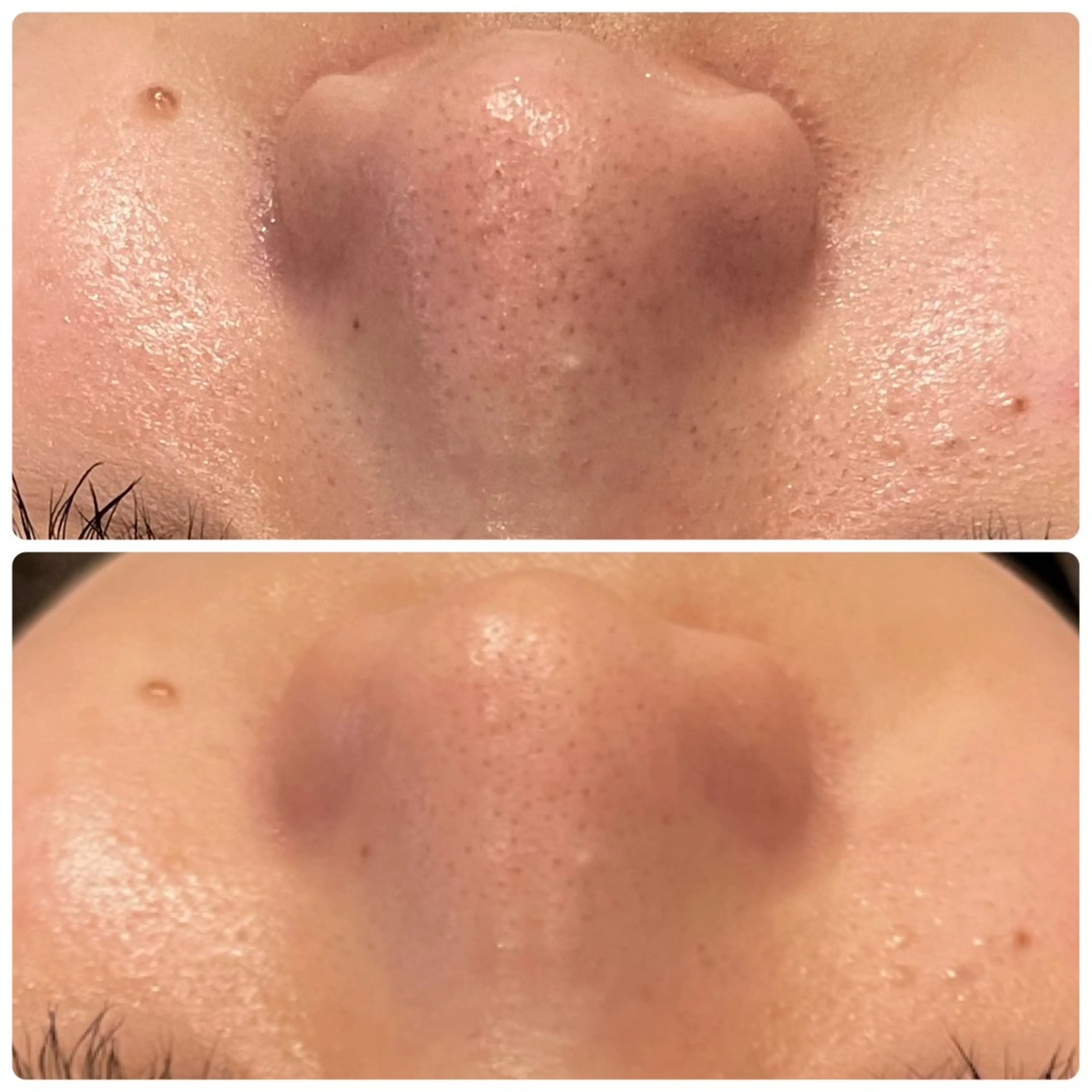 脱毛 yellow.所属・yellow💛【 脱毛&フェイシャル】のエステ・リラクイメージ