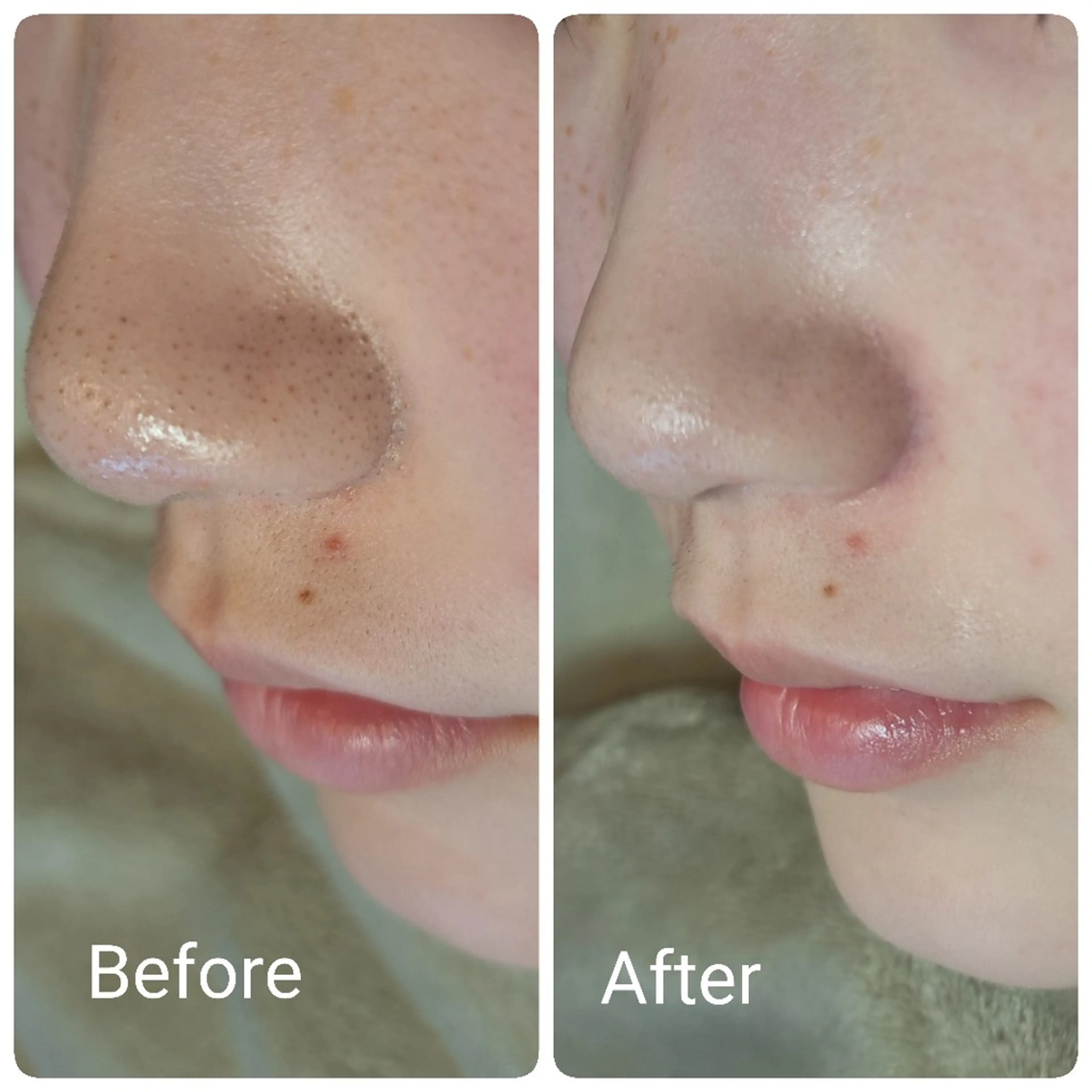 都度払いエステ Un Reve メンズ&レディース 津幡店所属・石黒 奈美子のエステ・リラクイメージ