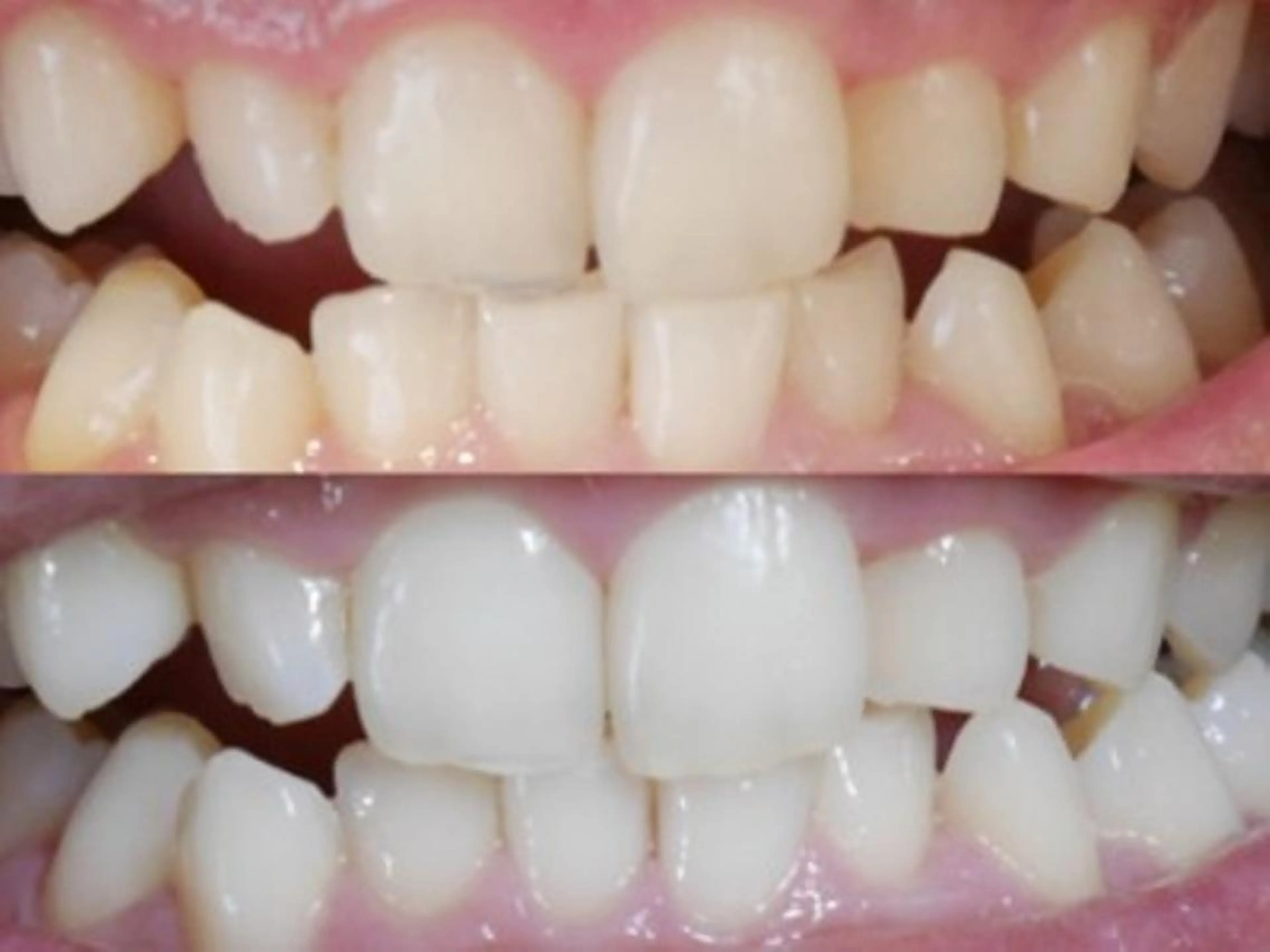 Twinkle White上尾店のエステ・リラクイメージ