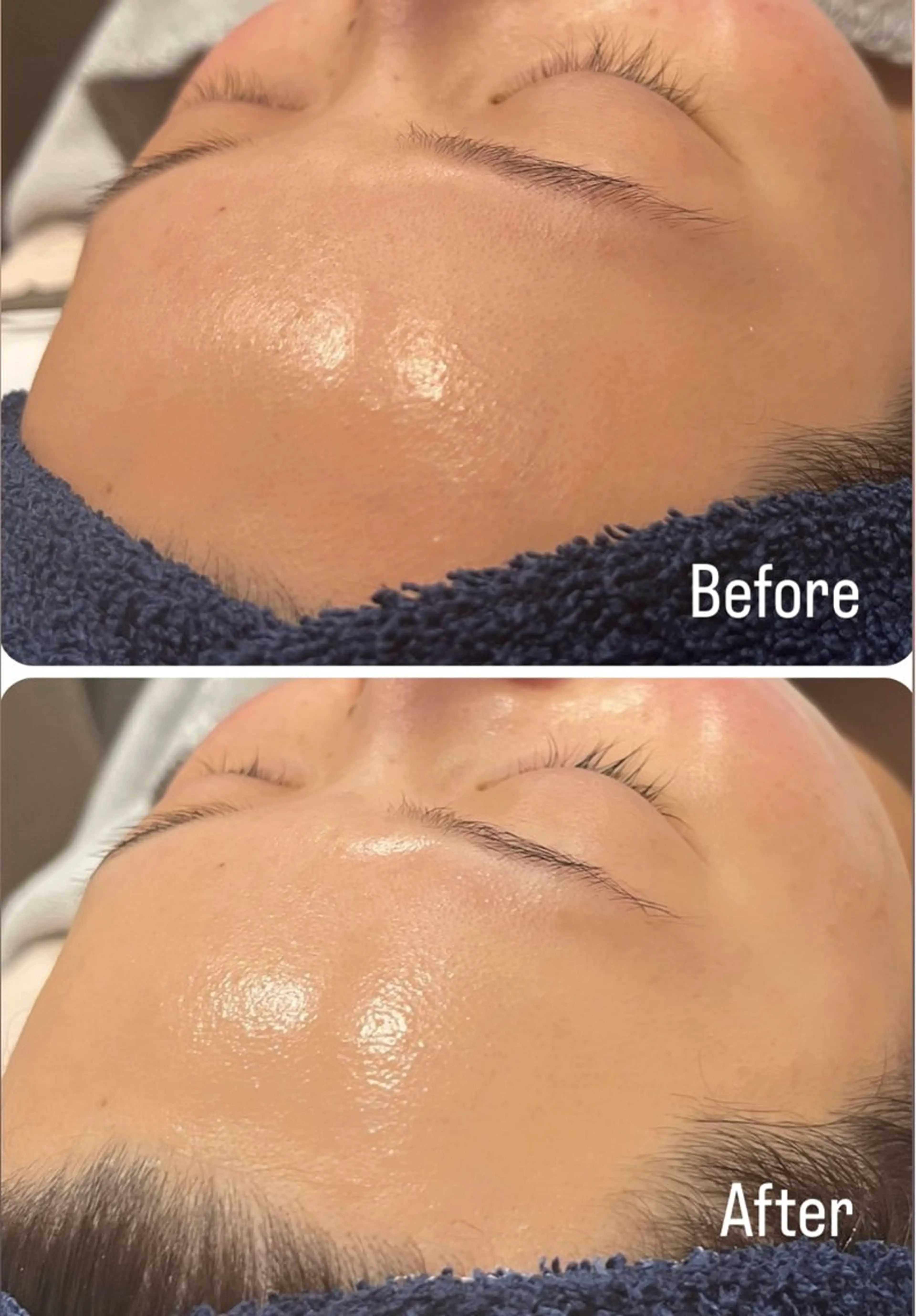 エステ アンド ミルルのエステ・リラクイメージ