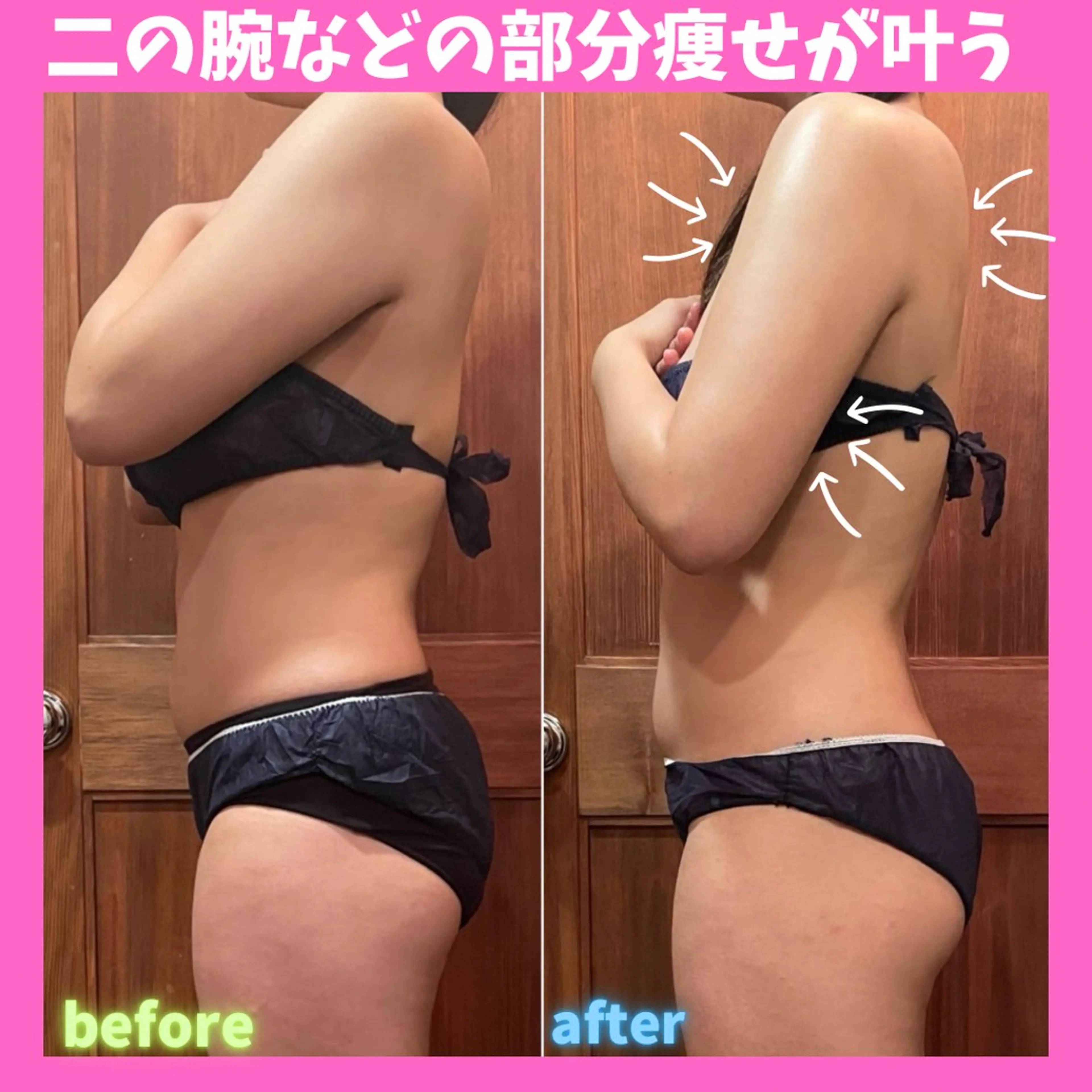 エステ 痩身&美肌サロン 堀米✨のその他イメージ