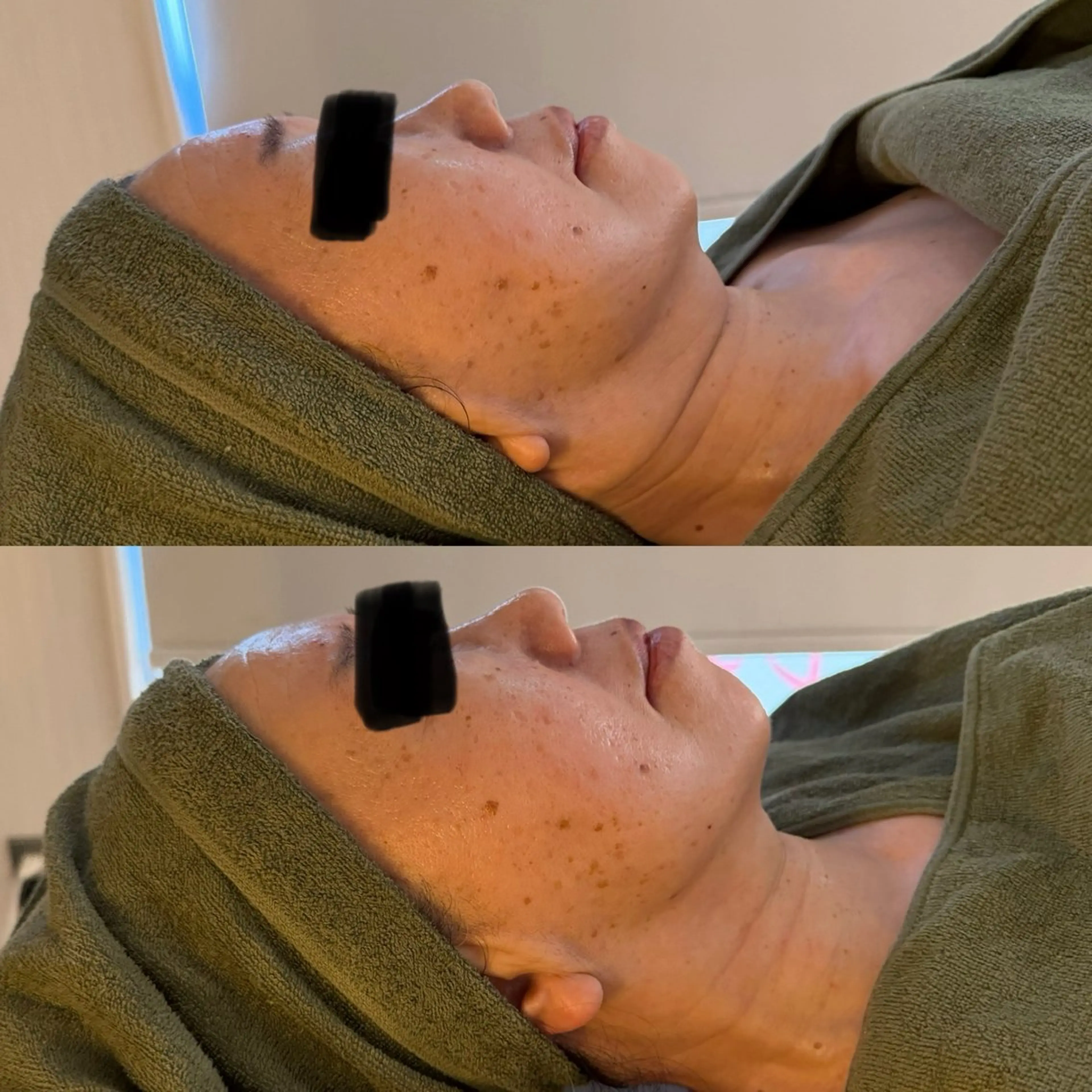 エステ リラク よもぎ蒸しサロンc.iエステティック所属・睡眠の質／体質改善 c.iエステティックのエステ・リラクイメージ