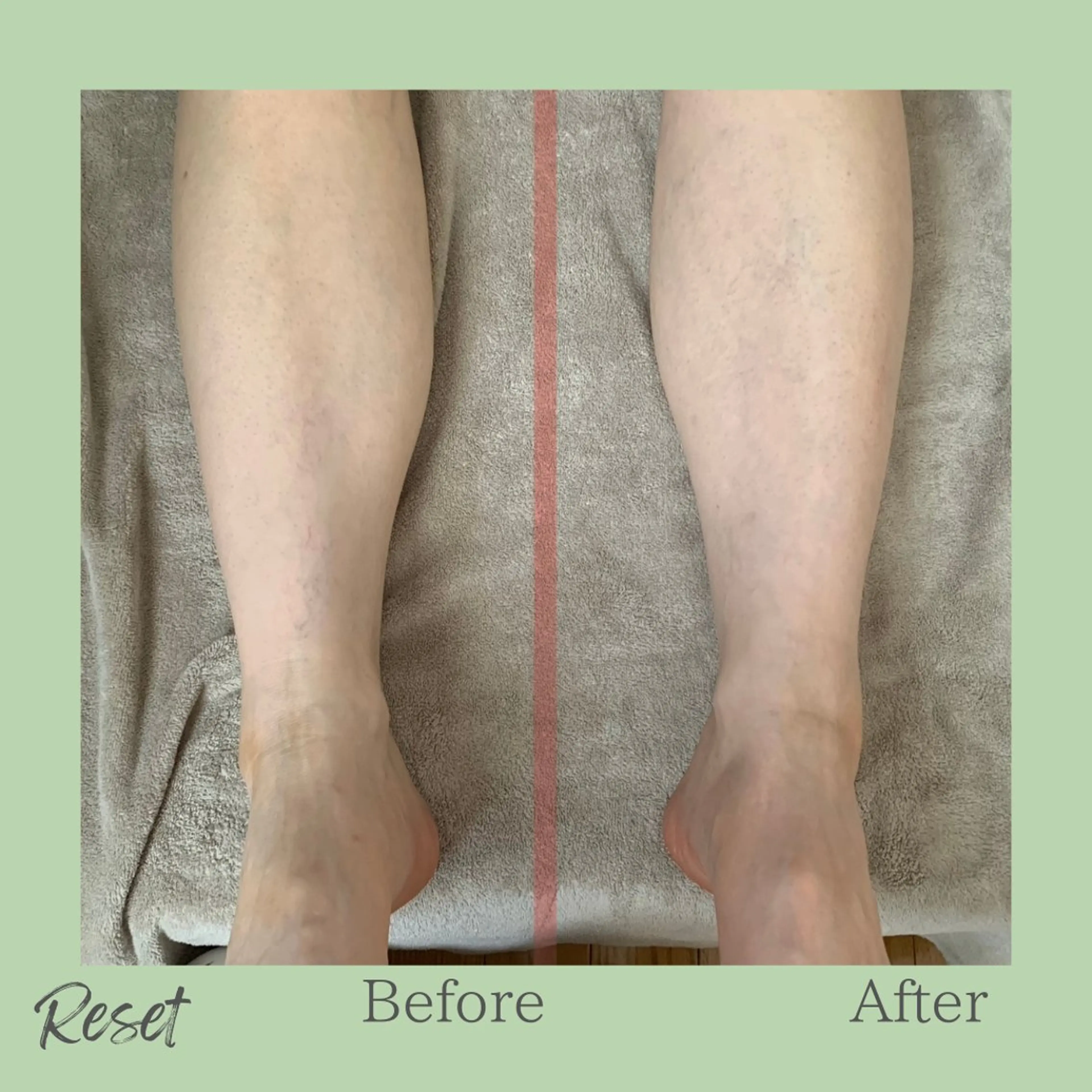 ボディケア/リラク Resetのエステ・リラクイメージ